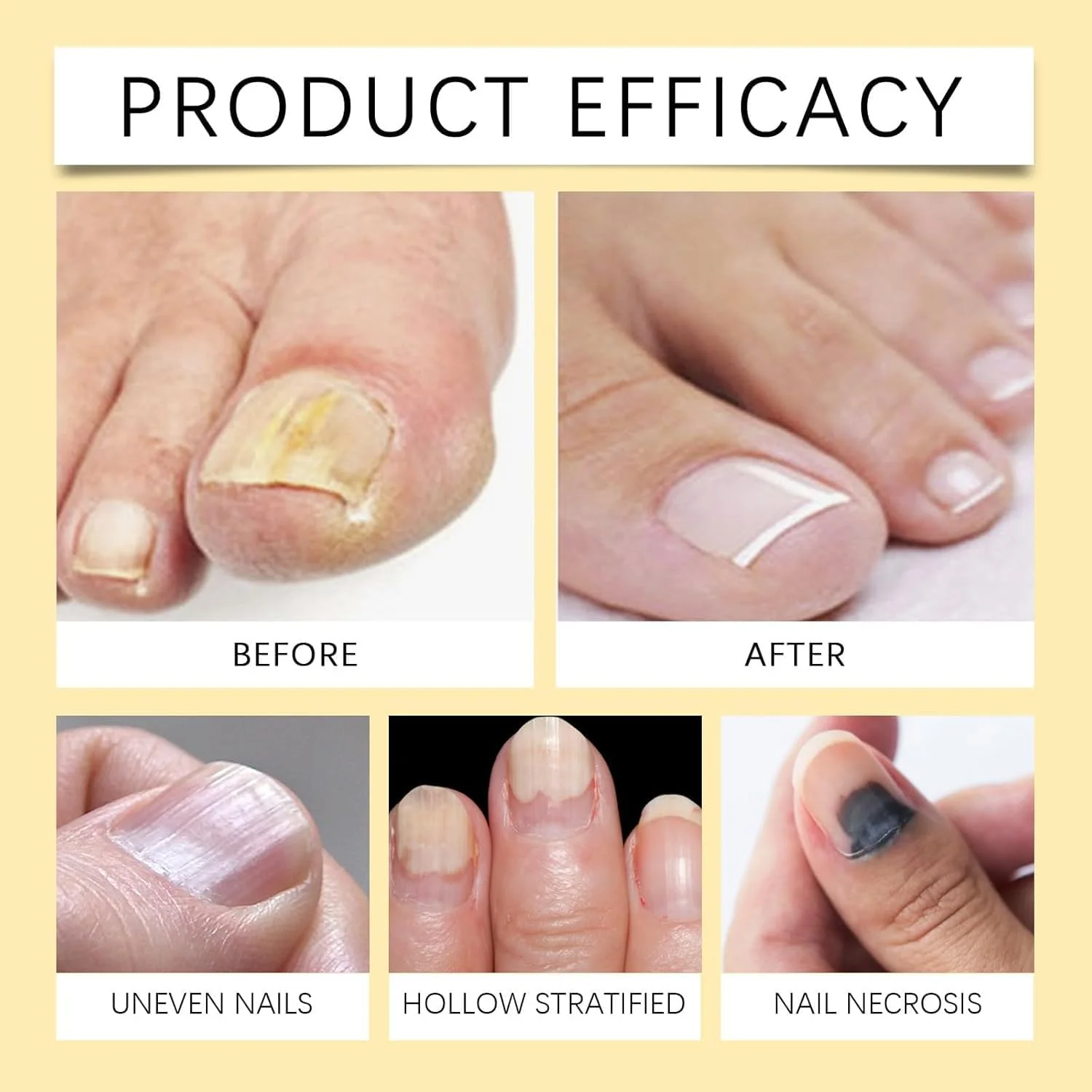 محلول تسکین دهنده و ضد قارچ ناخن، فرمول زنبور عسل با اثر سریع برای ناخن های دست و پا، تقویت کننده و افزایش دهنده رشد ناخن، محلول رفع قارچ برای ظاهر سالم تر ناخن محلول تسکین دهنده و ضد قارچ ناخن، فرمول زنبور عسل با اثر سریع برای ناخن های دست و پا، تقویت کننده و افزایش دهنده رشد ناخن، محلول رفع قارچ برای ظاهر سالم تر ناخن