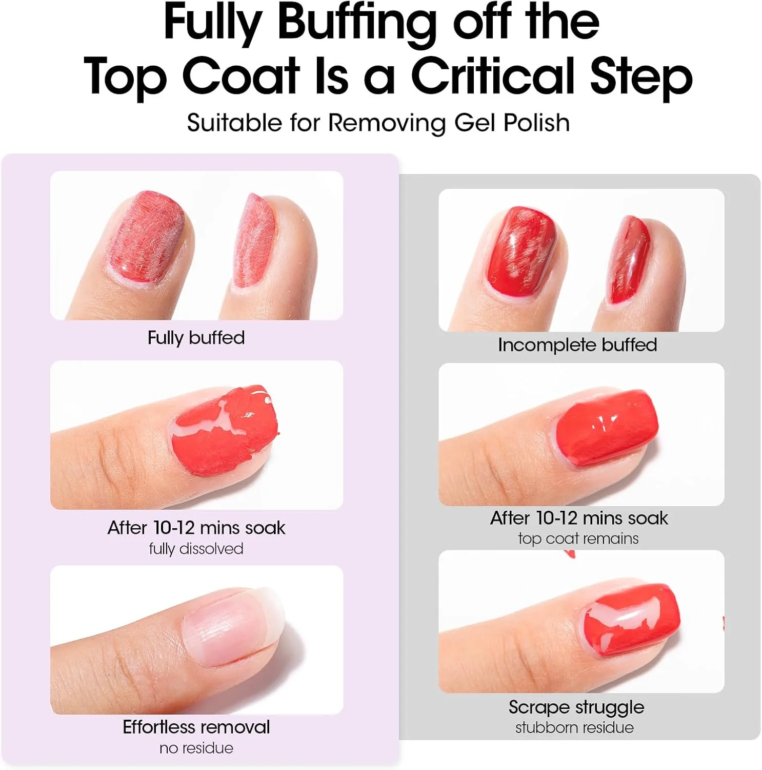 ژل پاک کننده لاک ژل GELLEN به همراه پد 200 عددی، ست مسافرتی عمده با سوهان ناخن و عقب زننده کوتیکول، بسته بندی جداگانه، R ژل پاک کننده لاک ژل GELLEN به همراه پد 200 عددی، ست مسافرتی عمده با سوهان ناخن و عقب زننده کوتیکول، بسته بندی جداگانه، R