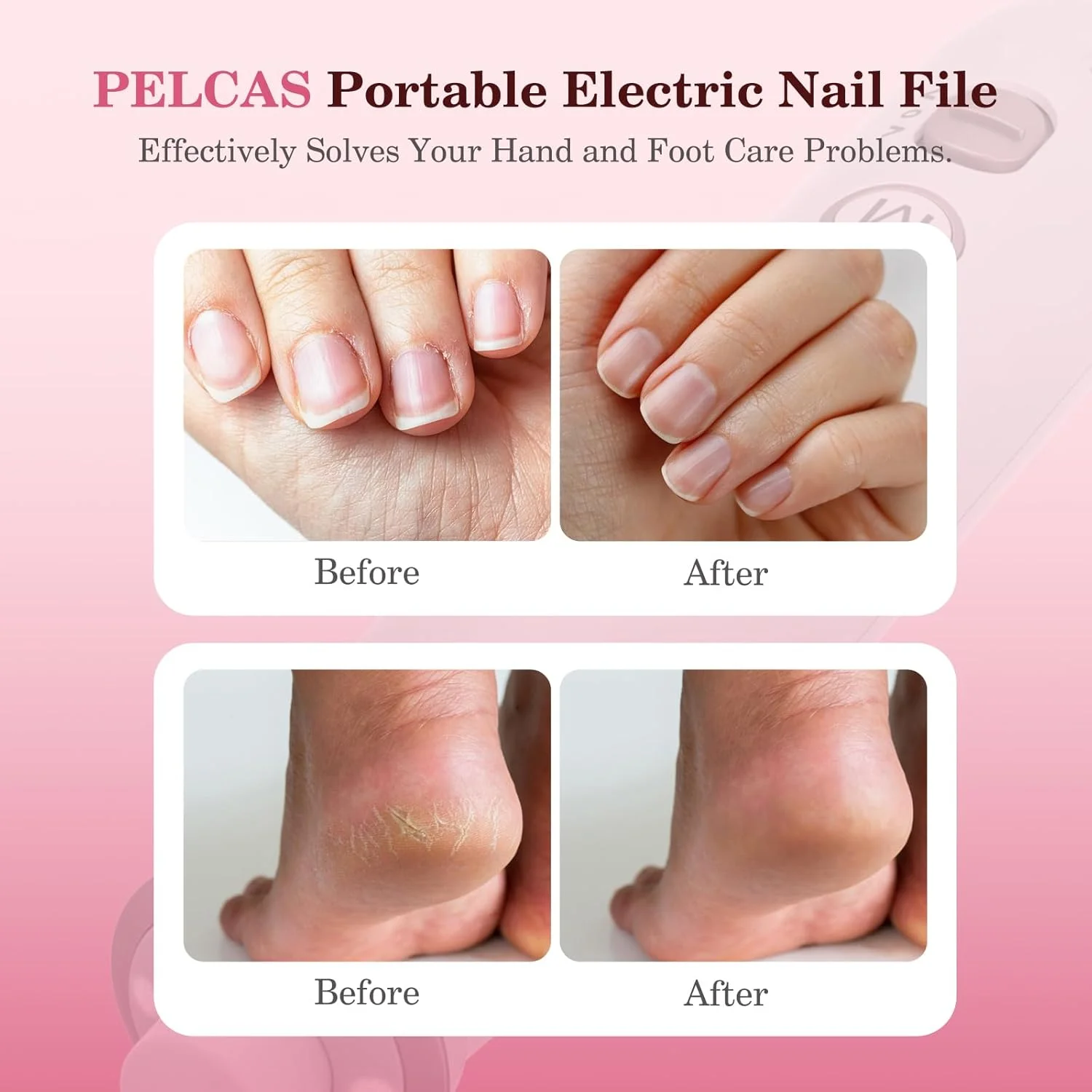 سوهان ناخن برقی PELCAS، دریل ناخن بی سیم 10 سرعته با چراغ LED، ست مانیکور و پدیکور قابل حمل، سنگ ناخن با صفحه نمایش LCD برای انسان، حیوان خانگی، ناخن های ضخیم پا، ناخن های طبیعی و اکریلیک