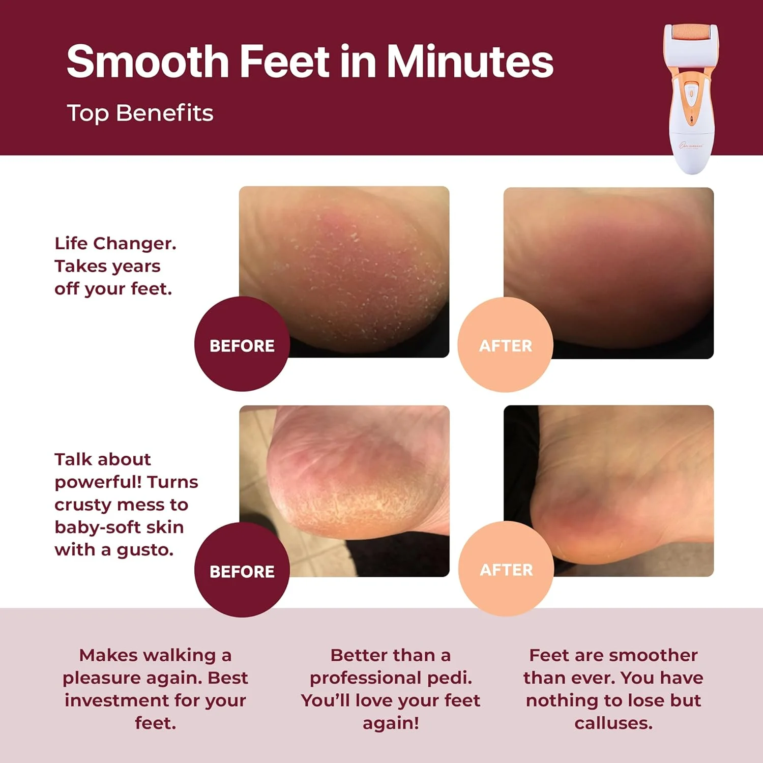 دستگاه سوهان برقی حرفه ای پا اون هارمونی برای مراقبت از پا - سوهان الکترونیکی پا مدل CR900 با 3 غلتک، سنگ پا برقی برای پاشنه های ترک خورده و پوست های سفت (کابل USB) دستگاه سوهان برقی حرفه ای پا اون هارمونی برای مراقبت از پا - سوهان الکترونیکی پا مدل CR900 با 3 غلتک، سنگ پا برقی برای پاشنه های ترک خورده و پوست های سفت (کابل USB)