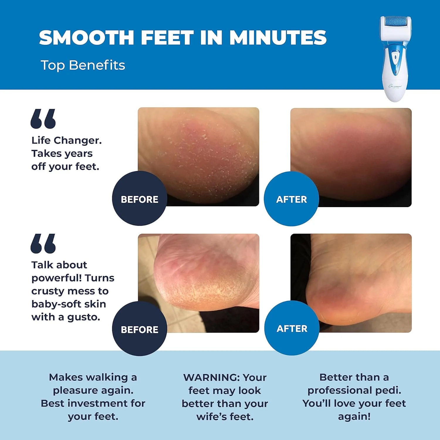 سوهان برقی پا: سوهان شارژی CR900 از Own Harmony - بهترین ابزار پدیکور با 3 غلتک، سمباده حرفه ای مراقبت از پا برای پاشنه های ترک خورده و پوست مرده (کابل USB)