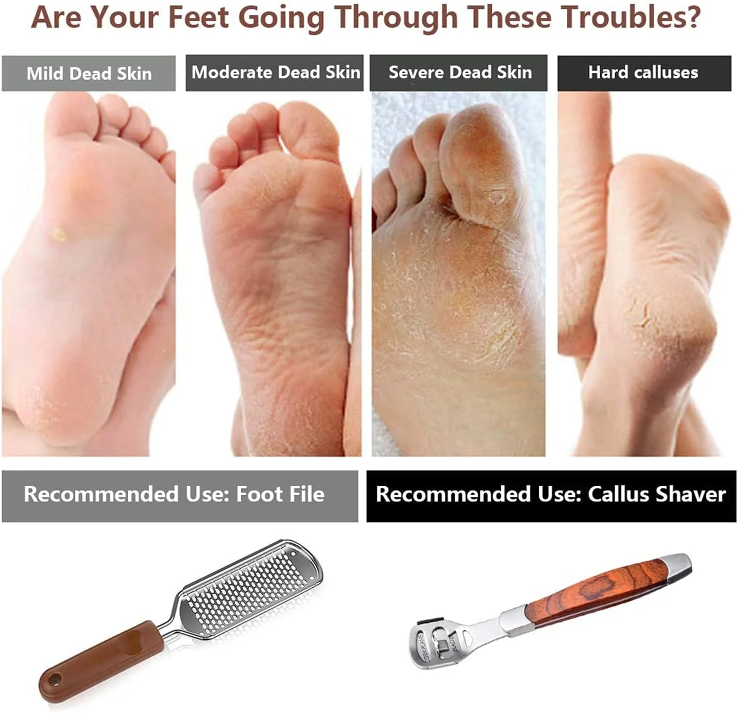 مجموعه سوهان پدیکور خزنا، رنده پدیکور بزرگ و تراشنده پینه دسته چوبی (10 تیغه تعویضی و 1 سری سوهان پا)، کیت سوهان پدیکور پا، خراشنده پاشنه پا، از بین برنده پینه پا مجموعه سوهان پدیکور خزنا، رنده پدیکور بزرگ و تراشنده پینه دسته چوبی (10 تیغه تعویضی و 1 سری سوهان پا)، کیت سوهان پدیکور پا، خراشنده پاشنه پا، از بین برنده پینه پا