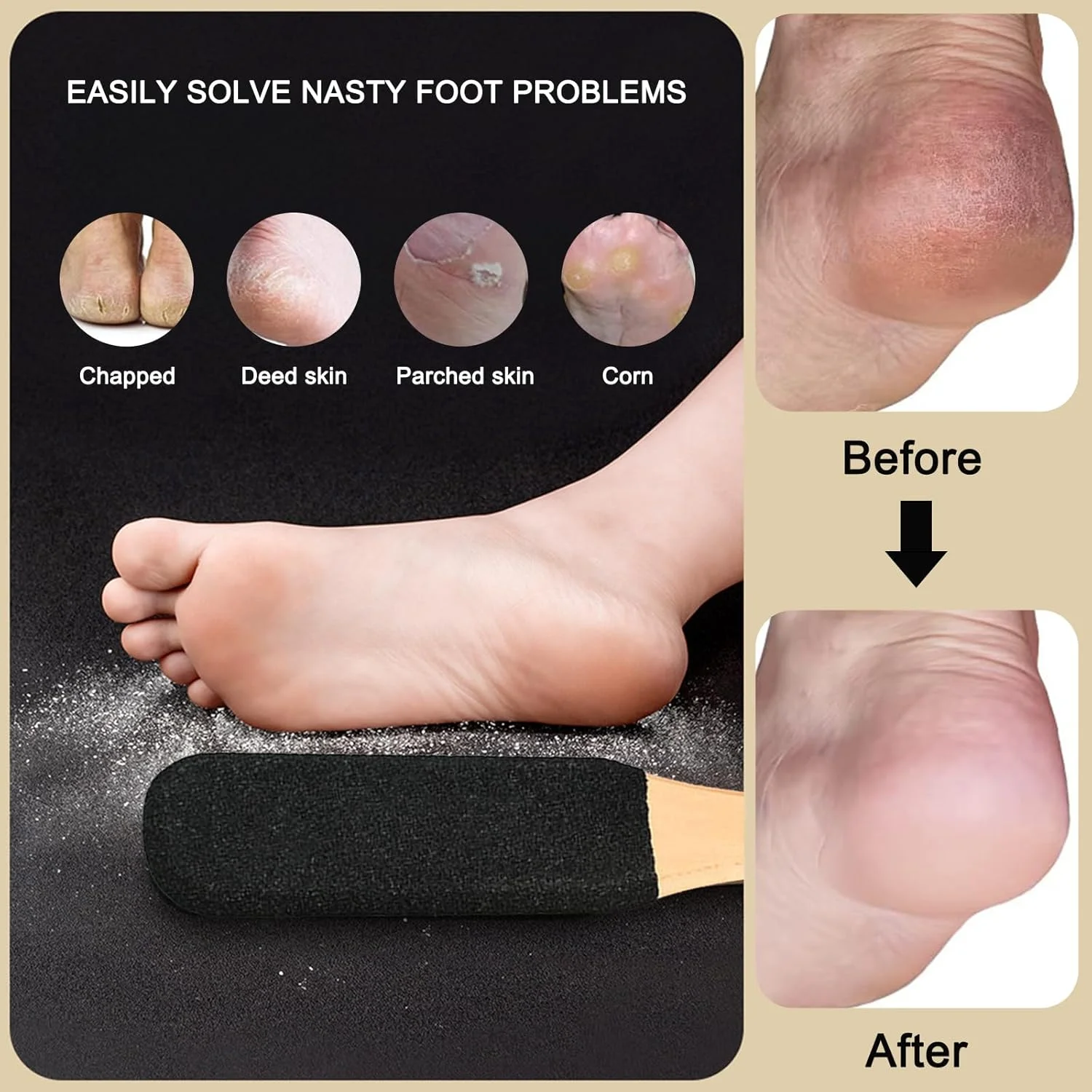 سوهان حرفه ای پا، از بین برنده موثر پینه و اسکرابر پا برای پاشنه های ترک خورده، پوست مرده، میخچه و پوست سخت، سنگ پا برای پاهای خیس و خشک (کاربید سیلیکون سیاه)