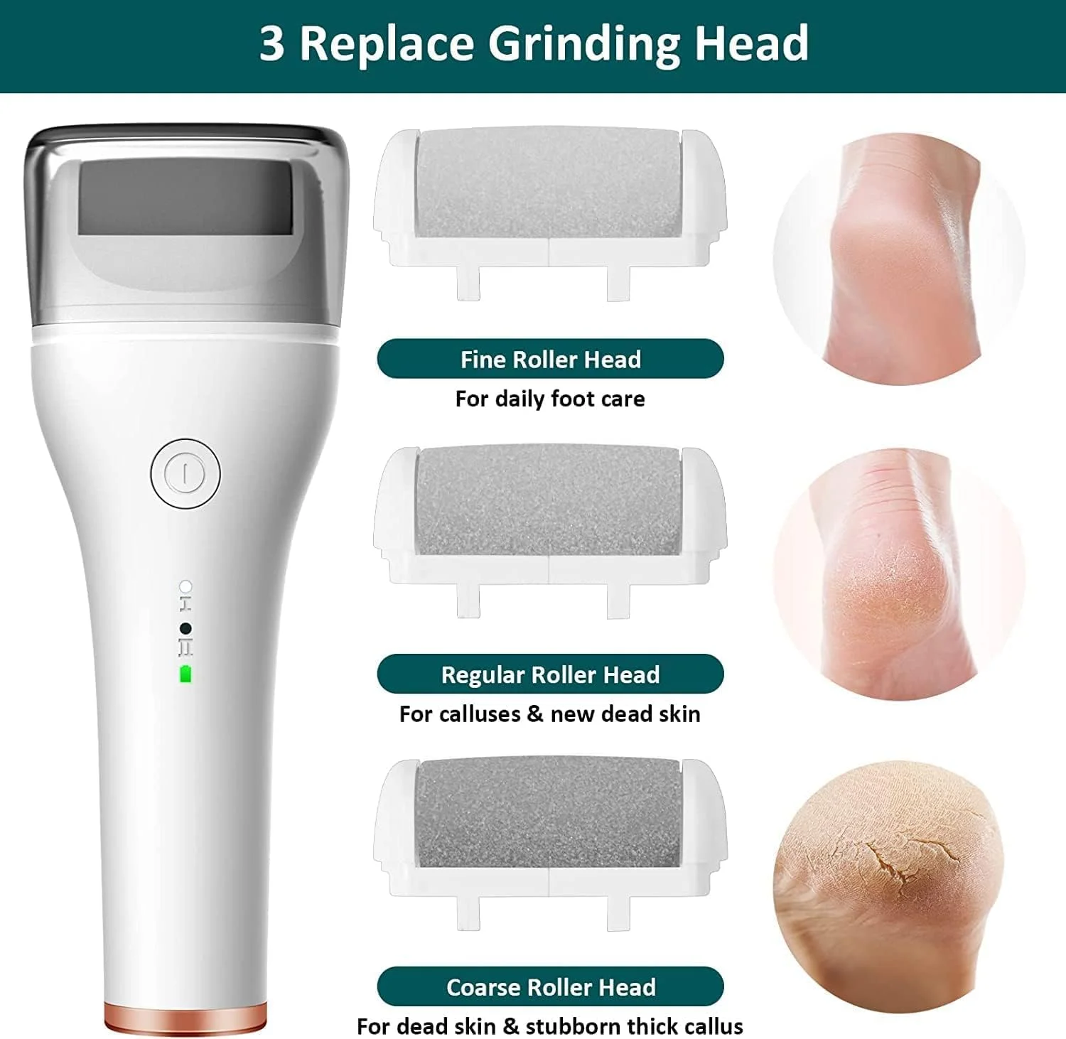 ست سوهان برقی پا Excefore، دستگاه حرفه ای شارژی از بین برنده پوست سفت پا با 3 غلتک و 2 سرعت، ضد آب، از بین برنده پوست مرده خشک، سفید ست سوهان برقی پا Excefore، دستگاه حرفه ای شارژی از بین برنده پوست سفت پا با 3 غلتک و 2 سرعت، ضد آب، از بین برنده پوست مرده خشک، سفید