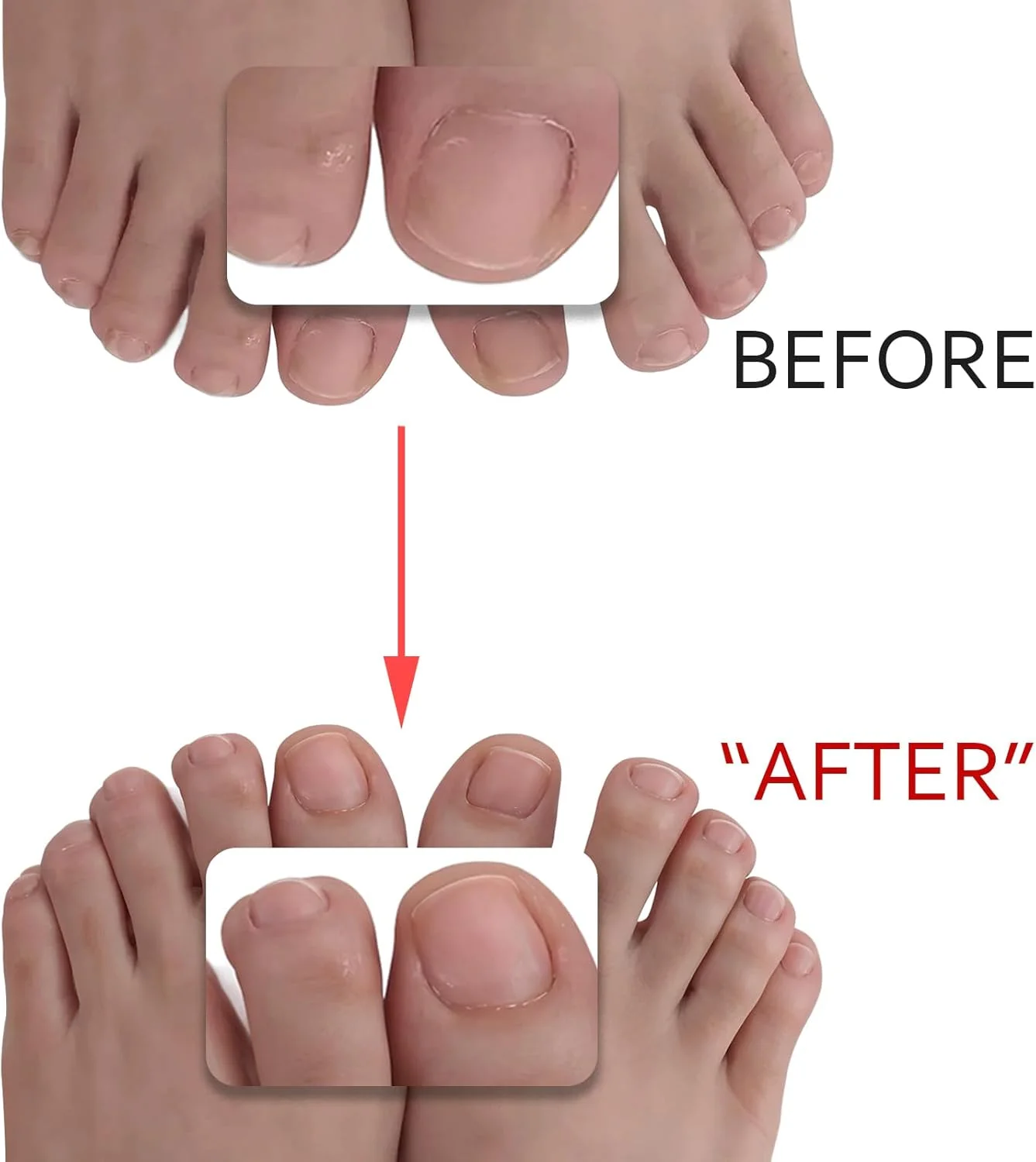 دو عدد سوهان ناخن پا JIEYAO برای ناخن های ضخیم، سوهان ناخن استیل ضد زنگ برای خانم ها، سوهان ناخن 4 طرفه، ابزار حرفه ای مانیکور پدیکور برای آقایان، سالمندان و سگ ها