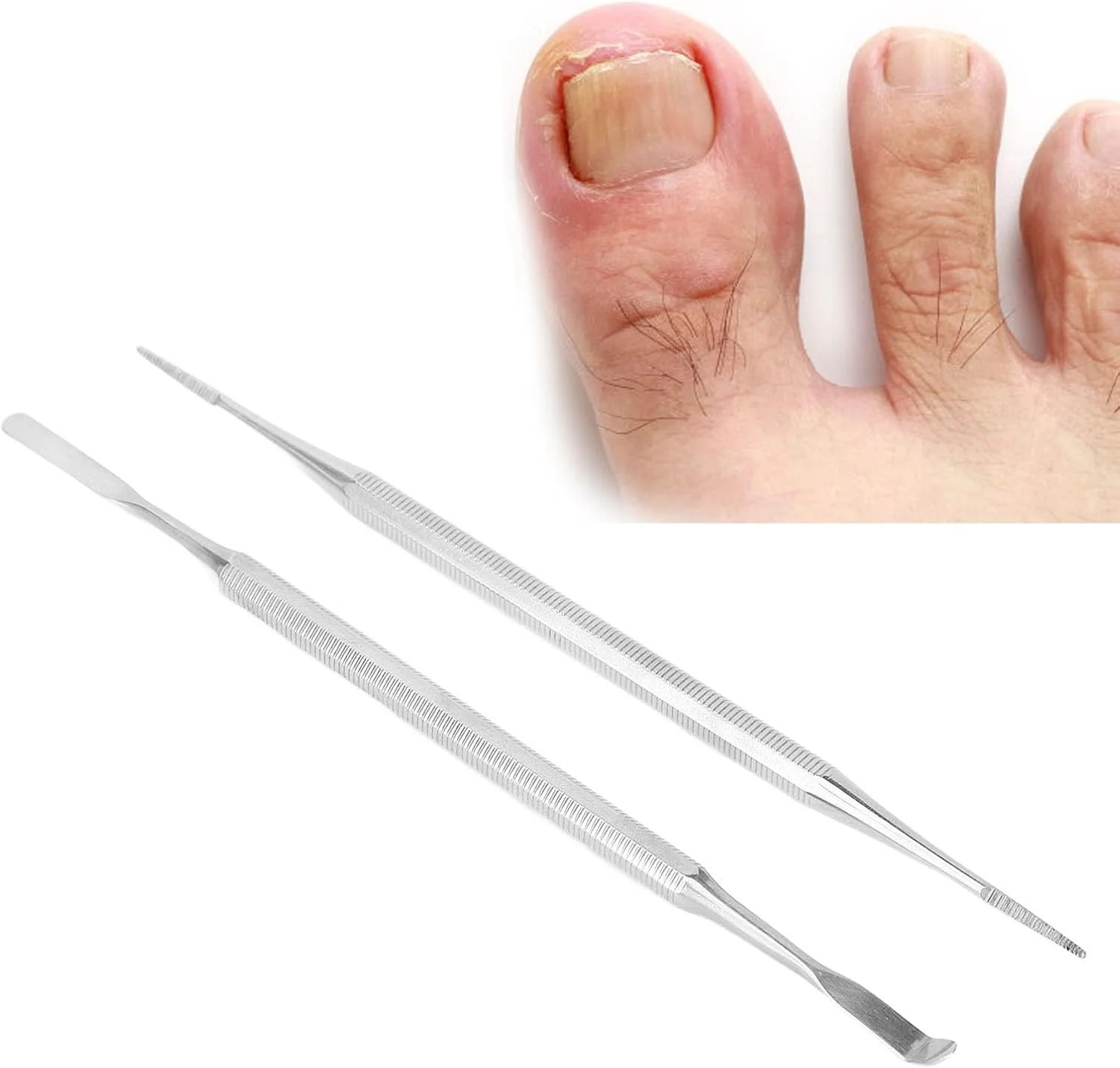 ست حرفه ای سوهان و لیفتر ناخن پا فرورفته، کیت ابزار ناخن پا فرورفته دو سر از جنس استیل ضد زنگ با دسته ارگونومیک برای منزل، مسافرت، سالن پدیکور