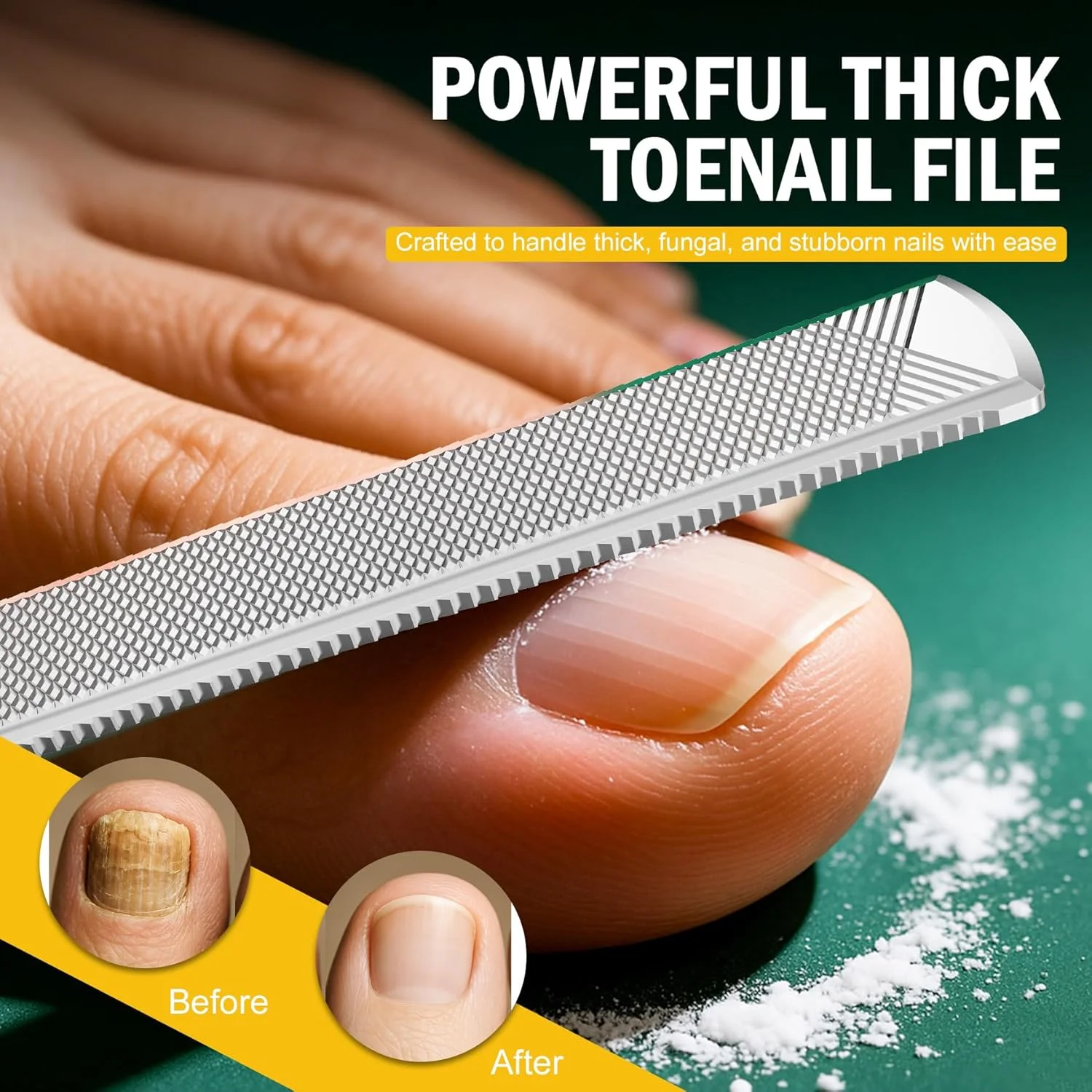 سوهان ناخن پا FVION برای ناخن های ضخیم و لیفتر ناخن پا، ست 2 عددی سوهان ناخن استیل ضد زنگ و تسکین ناخن فرورفته، سوهان فلزی بادوام برای سالمندان، ابزار پدیکور مردانه و زنانه (سبز)