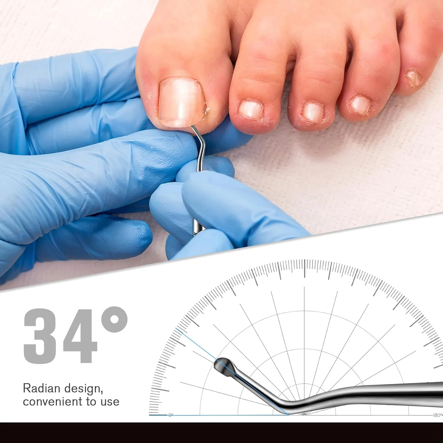 ابزار ناخن فرو رفته FERYES، ست لیفتر و سوهان ناخن برای درمان ناخن های فرو رفته - فولاد ضد زنگ درجه جراحی - همراه با جعبه نگهداری حلبی