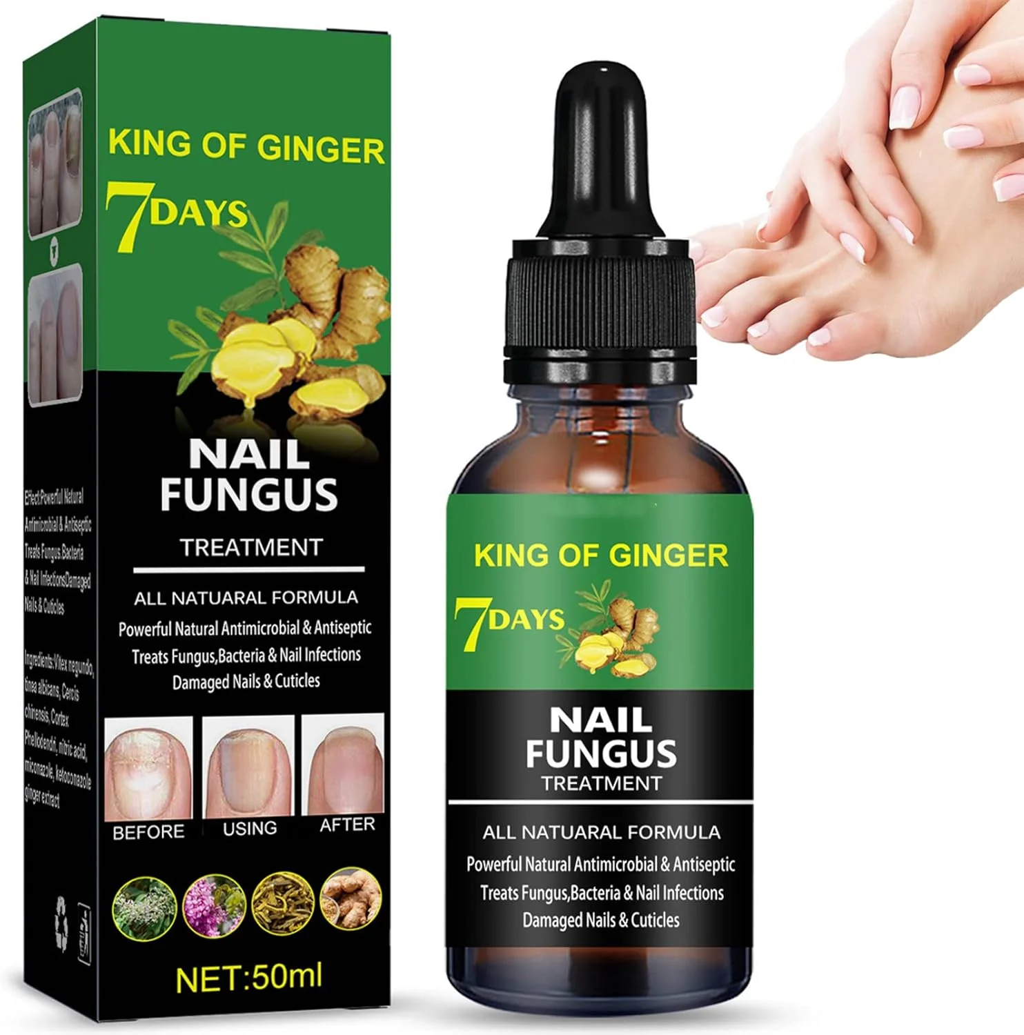 روغن درمان ناخن فرورفته، قطره رفع ناخن فرورفته، درمان قارچ ناخن پا، روغن مراقبت از کوتیکول ناخن پا