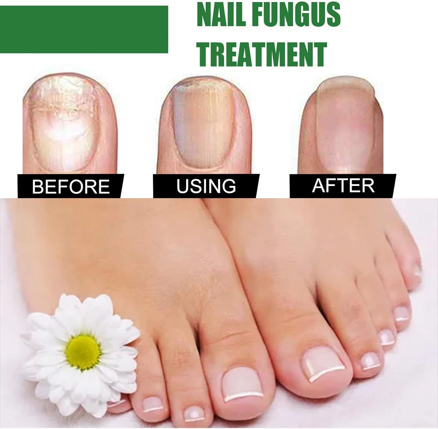 روغن درمان ناخن فرورفته، قطره رفع ناخن فرورفته، درمان قارچ ناخن پا، روغن مراقبت از کوتیکول ناخن پا روغن درمان ناخن فرورفته، قطره رفع ناخن فرورفته، درمان قارچ ناخن پا، روغن مراقبت از کوتیکول ناخن پا