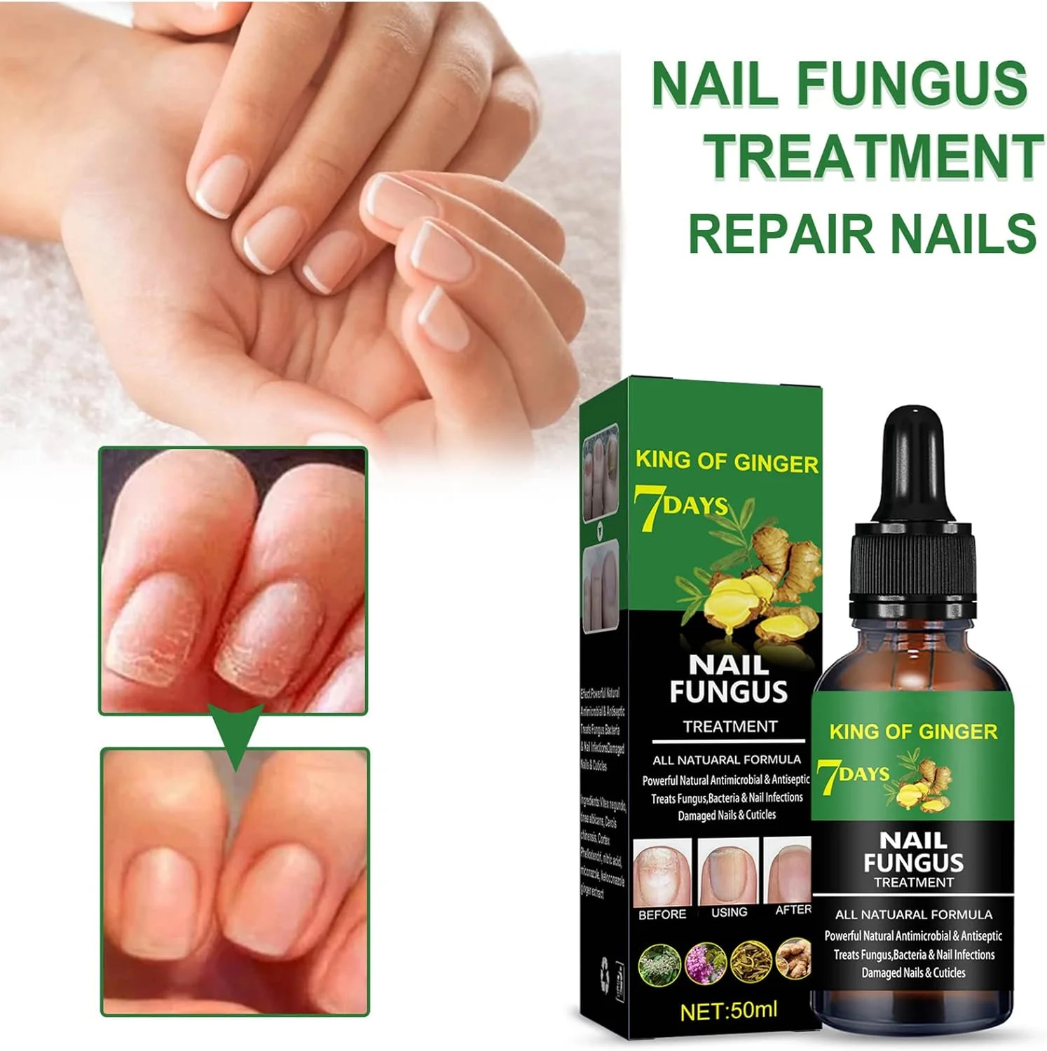 روغن درمان ناخن فرورفته، قطره رفع ناخن فرورفته، درمان قارچ ناخن پا، روغن مراقبت از کوتیکول ناخن پا روغن درمان ناخن فرورفته، قطره رفع ناخن فرورفته، درمان قارچ ناخن پا، روغن مراقبت از کوتیکول ناخن پا