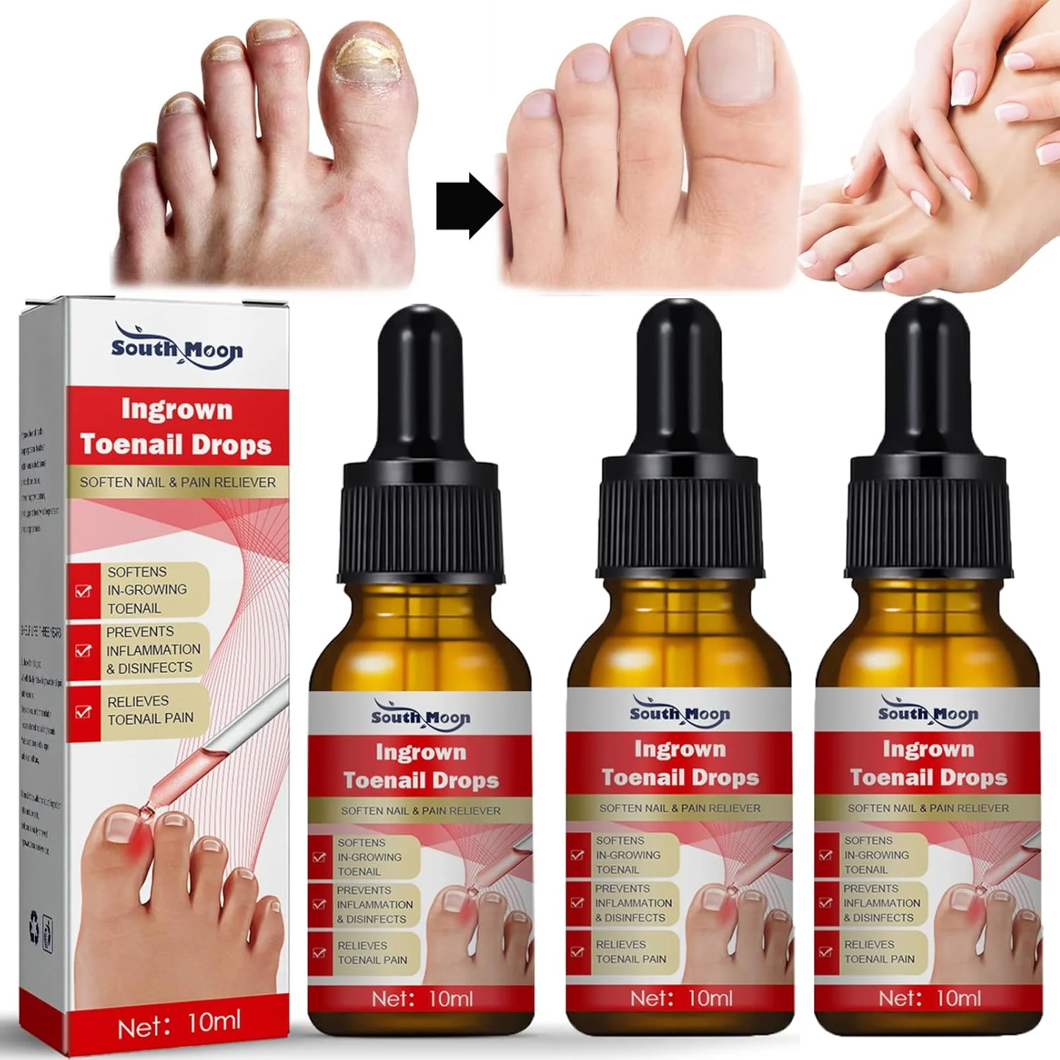 محلول درمان ناخن فرورفته، قطره اصلاح ناخن فرورفته، روغن مراقبت از کوتیکول برای ناخن های فرورفته، کیت نرم کننده و تسکین دهنده درد ناخن فرورفته، درمان قارچ ناخن (10 میلی لیتر، 3 عدد)