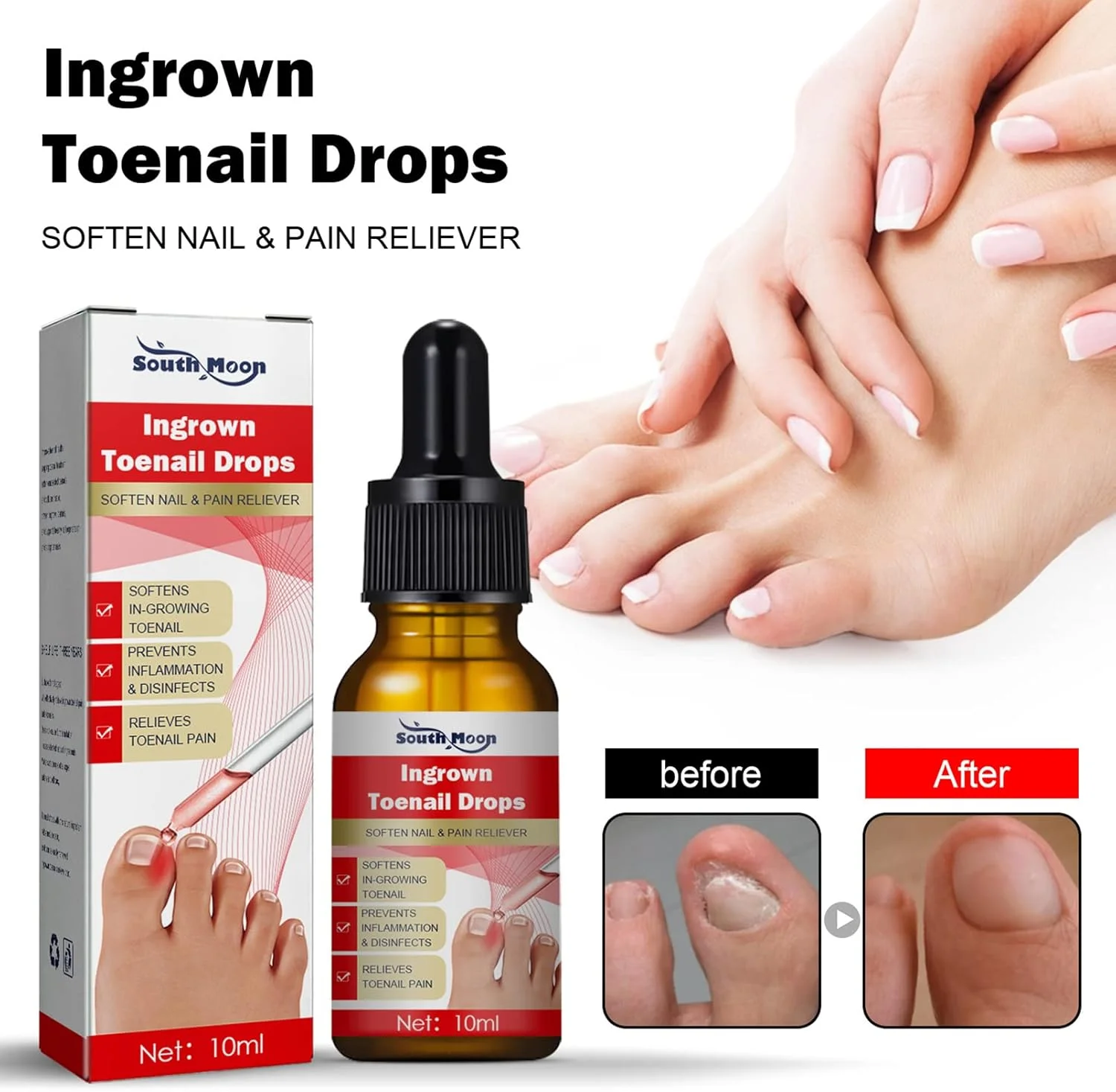 محلول درمان ناخن فرورفته، قطره اصلاح ناخن فرورفته، روغن مراقبت از کوتیکول برای ناخن های فرورفته، کیت نرم کننده و تسکین دهنده درد ناخن فرورفته، درمان قارچ ناخن (10 میلی لیتر، 3 عدد) محلول درمان ناخن فرورفته، قطره اصلاح ناخن فرورفته، روغن مراقبت از کوتیکول برای ناخن های فرورفته، کیت نرم کننده و تسکین دهنده درد ناخن فرورفته، درمان قارچ ناخن (10 میلی لیتر، 3 عدد)