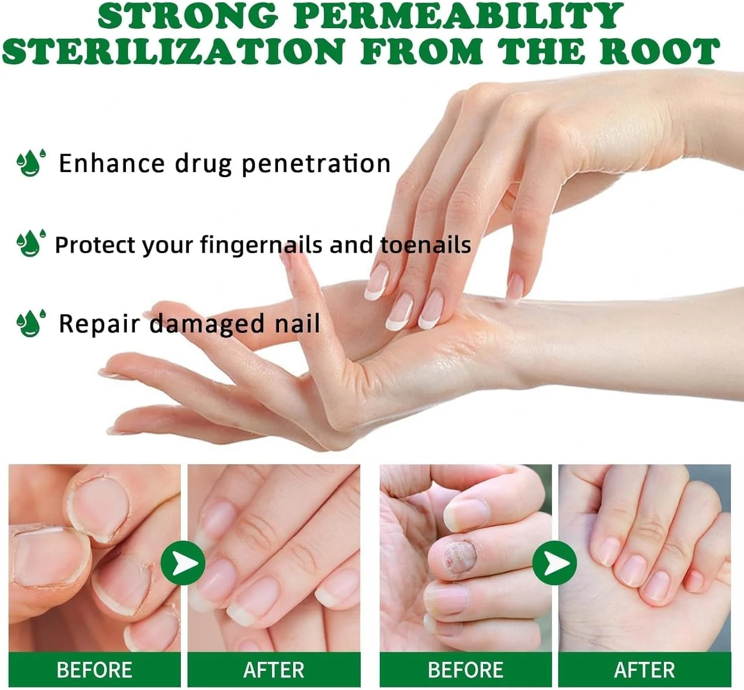 محلول مراقبت از ناخن، ترمیم ناخن پا با زنجبیل، سرم روغن مغذی مراقبت از ناخن انگشت برای ناخن های آسیب دیده و تغییر رنگ یافته محلول مراقبت از ناخن، ترمیم ناخن پا با زنجبیل، سرم روغن مغذی مراقبت از ناخن انگشت برای ناخن های آسیب دیده و تغییر رنگ یافته
