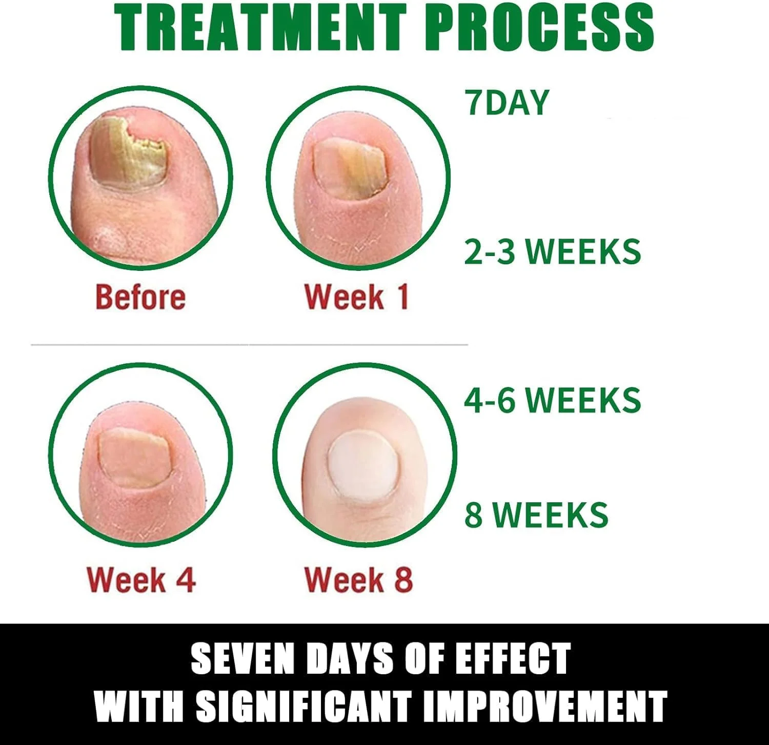 محلول مراقبت از ناخن، ترمیم ناخن پا با زنجبیل، سرم روغن مغذی مراقبت از ناخن انگشت برای ناخن های آسیب دیده و تغییر رنگ یافته محلول مراقبت از ناخن، ترمیم ناخن پا با زنجبیل، سرم روغن مغذی مراقبت از ناخن انگشت برای ناخن های آسیب دیده و تغییر رنگ یافته