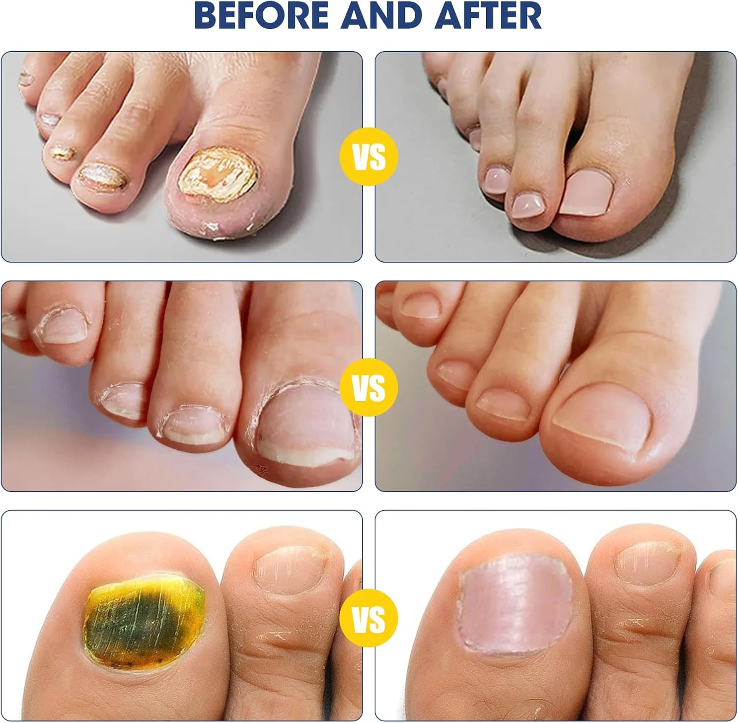 روغن ناخن سیلیسیا، سرم تقویت کننده و مراقبت از ناخن 30 میلی لیتری روغن ناخن سیلیسیا، سرم تقویت کننده و مراقبت از ناخن 30 میلی لیتری