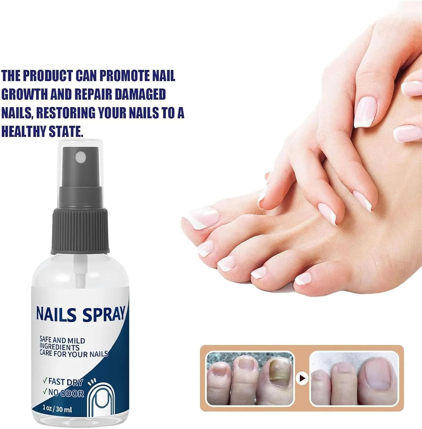 Nails Spray for Nails Care Moisturizer, Nail Strengthener and Growth for Damaged Nails, Keeps Feet Fresh & Dry All Day, Quick-Drying & Non-Greasy, Moisturizing Cuticle for Women & Men (1pc) Nails Spray for Nails Care Moisturizer, Nail Strengthener and Growth for Damaged Nails, Keeps Feet Fresh & Dry All Day, Quick-Drying & Non-Greasy, Moisturizing Cuticle for Women & Men (1pc)