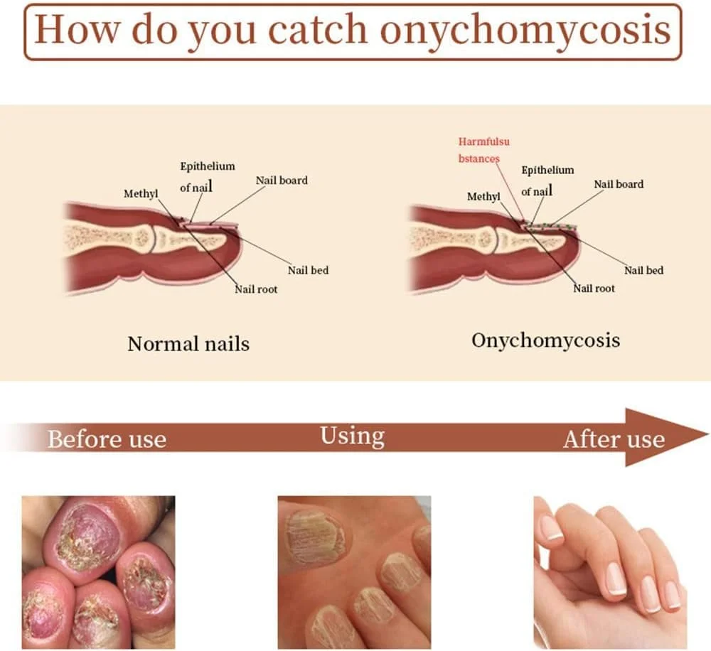 سرم تقویت کننده و رشد ناخن 7 روزه، سرم ترمیم کننده ناخن، روغن کوتیکول ناخن (1 عدد) سرم تقویت کننده و رشد ناخن 7 روزه، سرم ترمیم کننده ناخن، روغن کوتیکول ناخن (1 عدد)