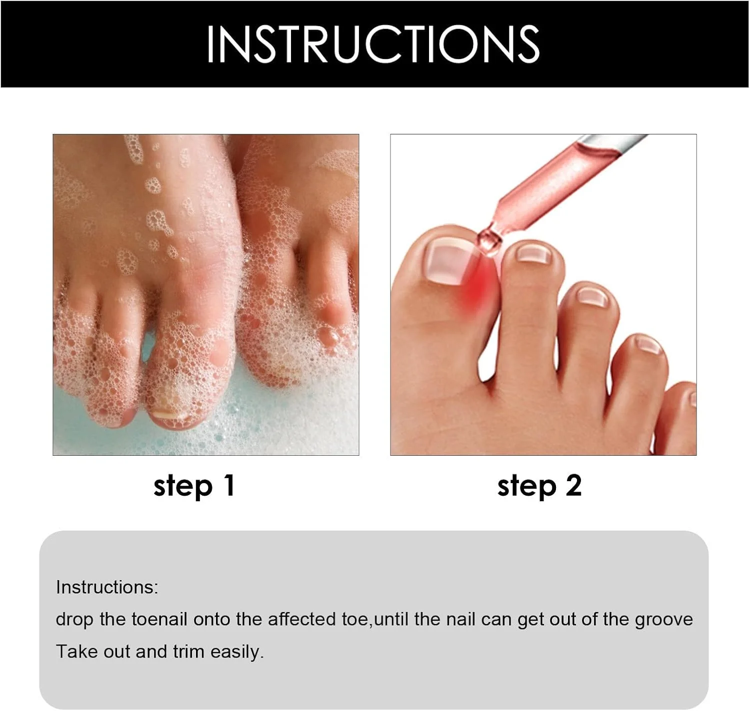 محلول درمان ناخن فرورفته، کمک کننده ناخن، درمان رشد ناخن، قطره ناخن فرورفته، روغن کوتیکول ناخن، اصلاح ناخن فرورفته، درمان قارچ ناخن پا، فوق العاده قوی برای ناخن های آسیب دیده محلول درمان ناخن فرورفته، کمک کننده ناخن، درمان رشد ناخن، قطره ناخن فرورفته، روغن کوتیکول ناخن، اصلاح ناخن فرورفته، درمان قارچ ناخن پا، فوق العاده قوی برای ناخن های آسیب دیده