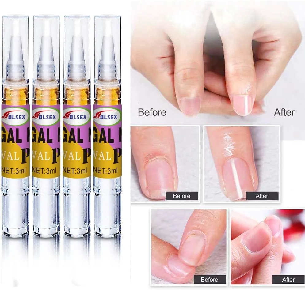 روغن کوتیکول برای مراقبت از ناخن، قلم ترمیم کننده موثر ناخن برای ناخن های آسیب دیده، برای ناخن های پا حاوی روغن درخت چای، ترمیم کننده ناخن های دست بسیار قوی 3 میلی لیتر * 4 عدد
