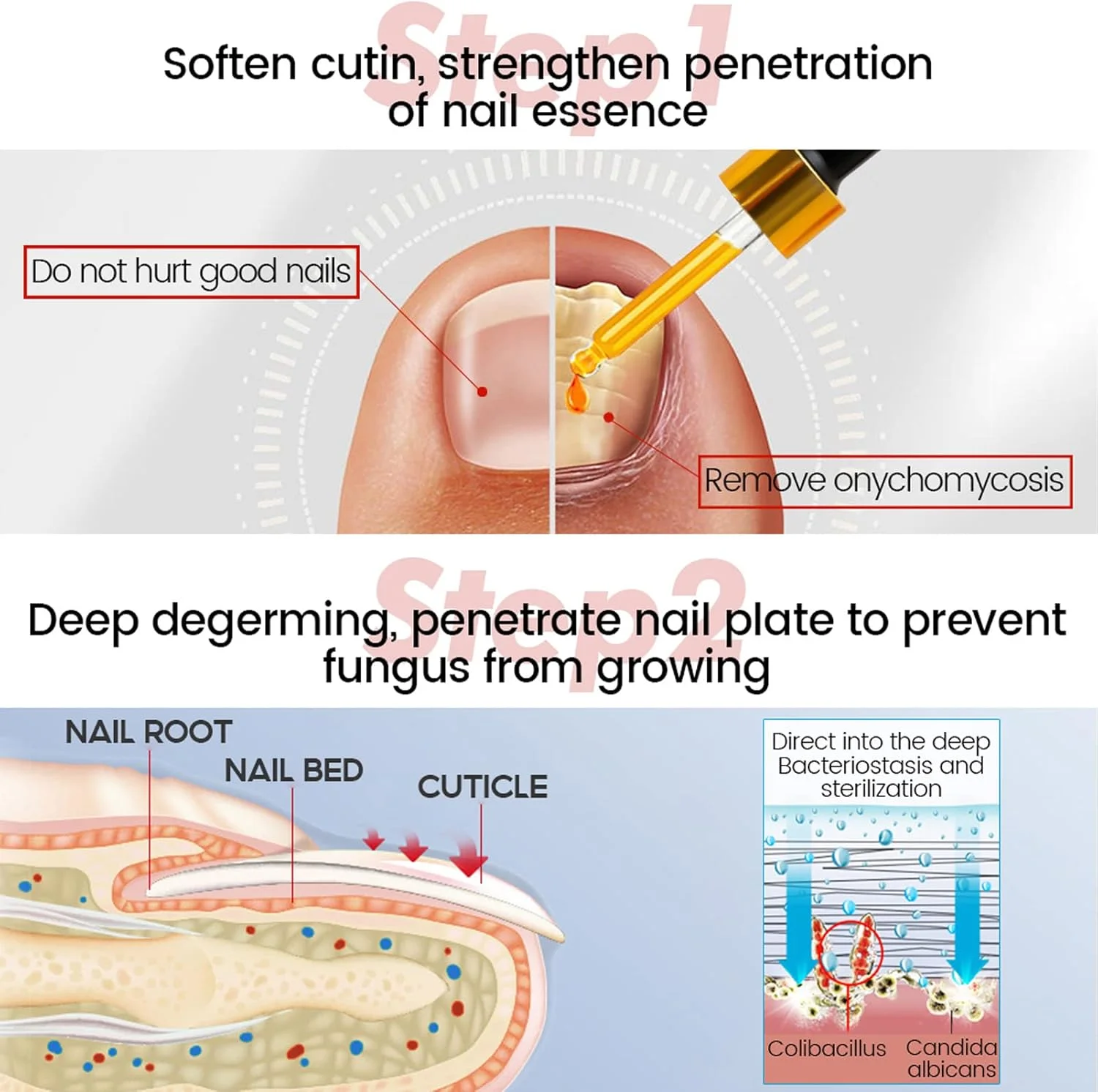 روغن درمان و اصلاح ناخن پا، روغن مراقبت از کوتیکول برای ناخن های فرورفته، مراقبت و درمان ناخن روغن درمان و اصلاح ناخن پا، روغن مراقبت از کوتیکول برای ناخن های فرورفته، مراقبت و درمان ناخن