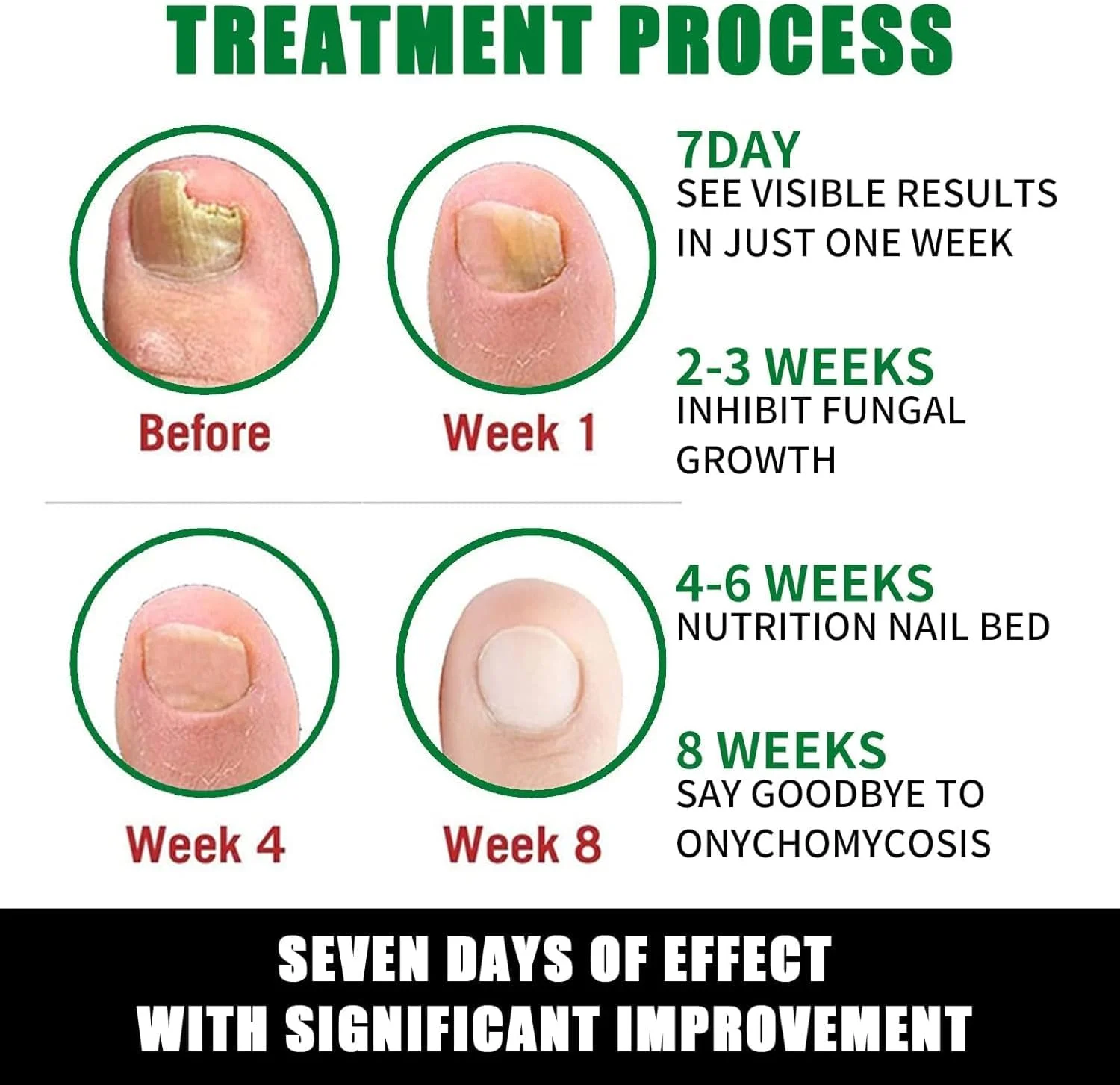 مراقبت از ناخن با زنجبیل - تقویت کننده و ترمیم کننده ناخن، سرم ناخن زنجبیل، روغن کوتیکول ناخن زنجبیل - درمان ۷ روزه