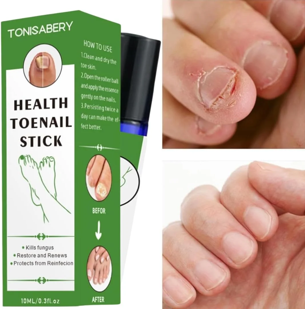 استیک ترمیم ناخن پا NIKITA.VIVI، غلتکی ترمیم ناخن ترک خورده، نرم کننده و تسکین دهنده طبیعی، روغن کوتیکول سالم تقویت کننده ناخن و محافظت از کوتیکول ها، استیک مایع از بین برنده قارچ ناخن