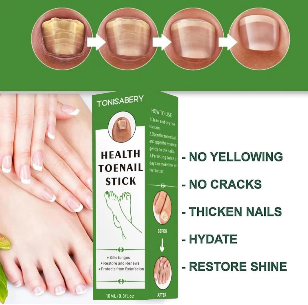 استیک ترمیم ناخن پا NIKITA.VIVI، غلتکی ترمیم ناخن ترک خورده، نرم کننده و تسکین دهنده طبیعی، روغن کوتیکول سالم تقویت کننده ناخن و محافظت از کوتیکول ها، استیک مایع از بین برنده قارچ ناخن