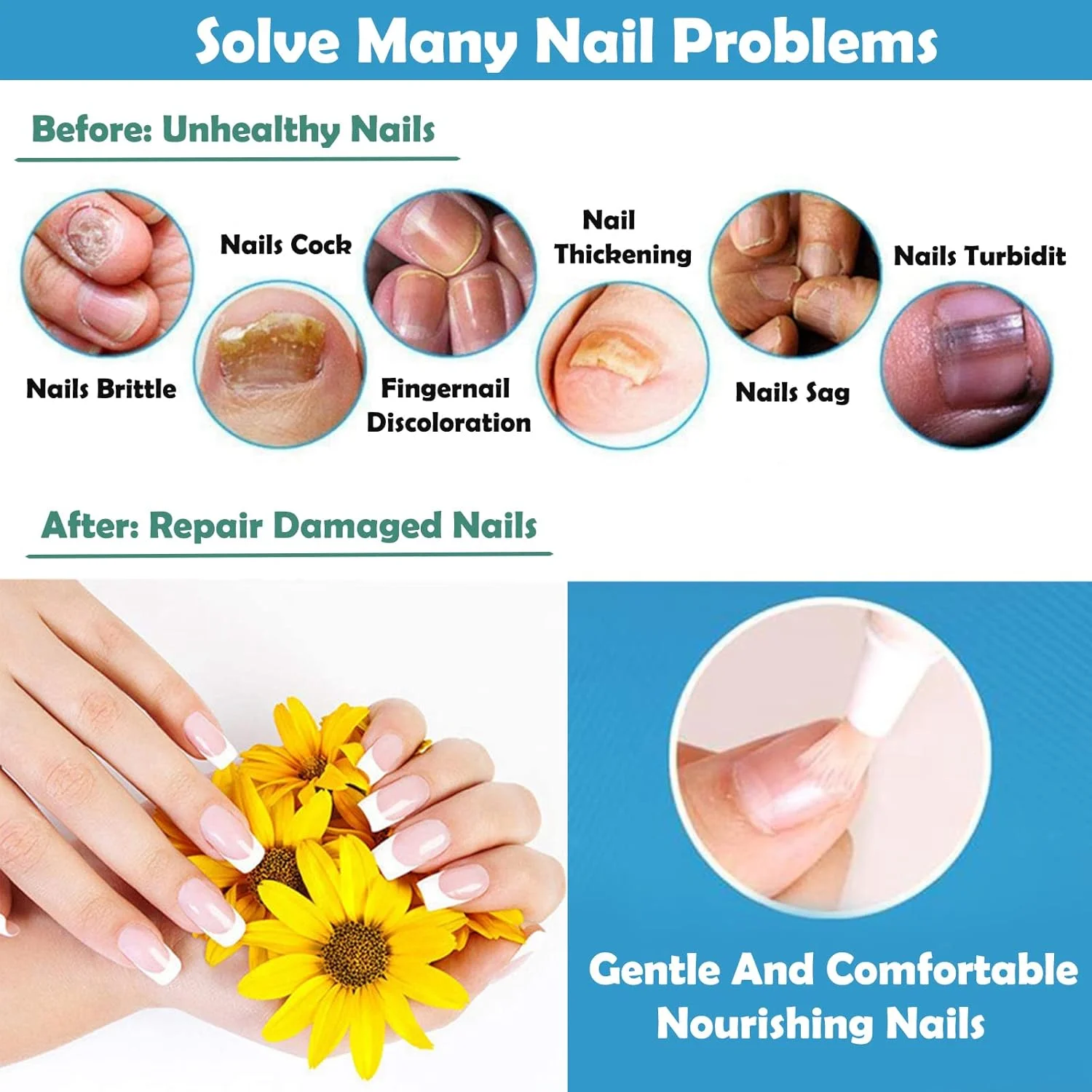 روغن کوتیکول مدادی ترمیم ناخن، 4 عدد درمان ضد قارچ ناخن برای ناخن های پا، روغن های مراقبت از ناخن، رفع تغییر رنگ و آسیب دیدگی ناخن ها