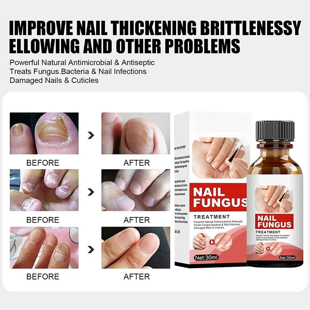 سرم تقویت کننده و رشد ناخن Tlopa، سرم رشد و استحکام ناخن، روغن تقویت کننده کوتیکول ناخن، اسانس ترمیم کننده سرم ناخن، محلول ترمیم ناخن (1 عدد)