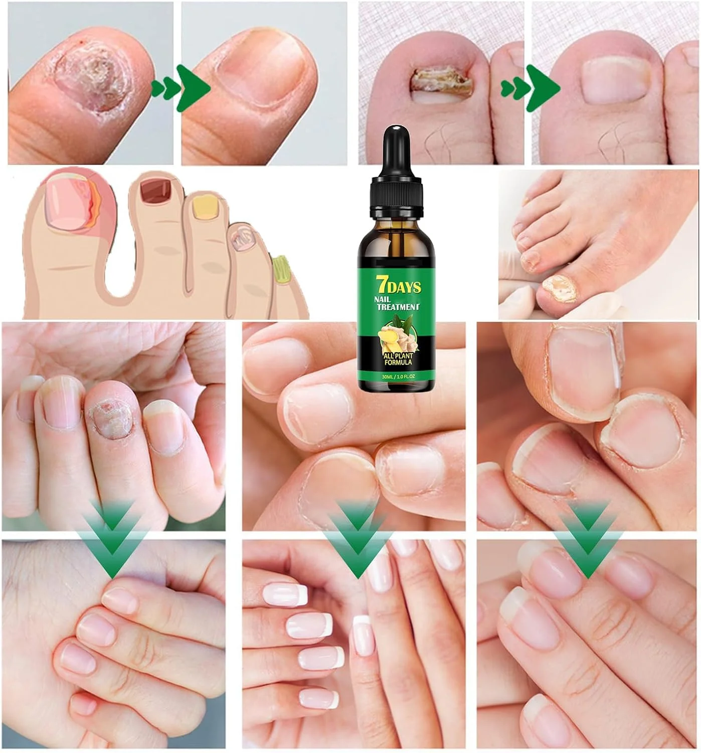 مراقبت از ناخن با زنجبیل، تقویت کننده ناخن، درمان ۷ روزه ناخن، سرم رشد ناخن زنجبیلی، روغن مراقبت از کوتیکول ناخن زنجبیلی، سرم کوتیکول ناخن (۲ عدد، ۳۰ میلی لیتر) مراقبت از ناخن با زنجبیل، تقویت کننده ناخن، درمان ۷ روزه ناخن، سرم رشد ناخن زنجبیلی، روغن مراقبت از کوتیکول ناخن زنجبیلی، سرم کوتیکول ناخن (۲ عدد، ۳۰ میلی لیتر)