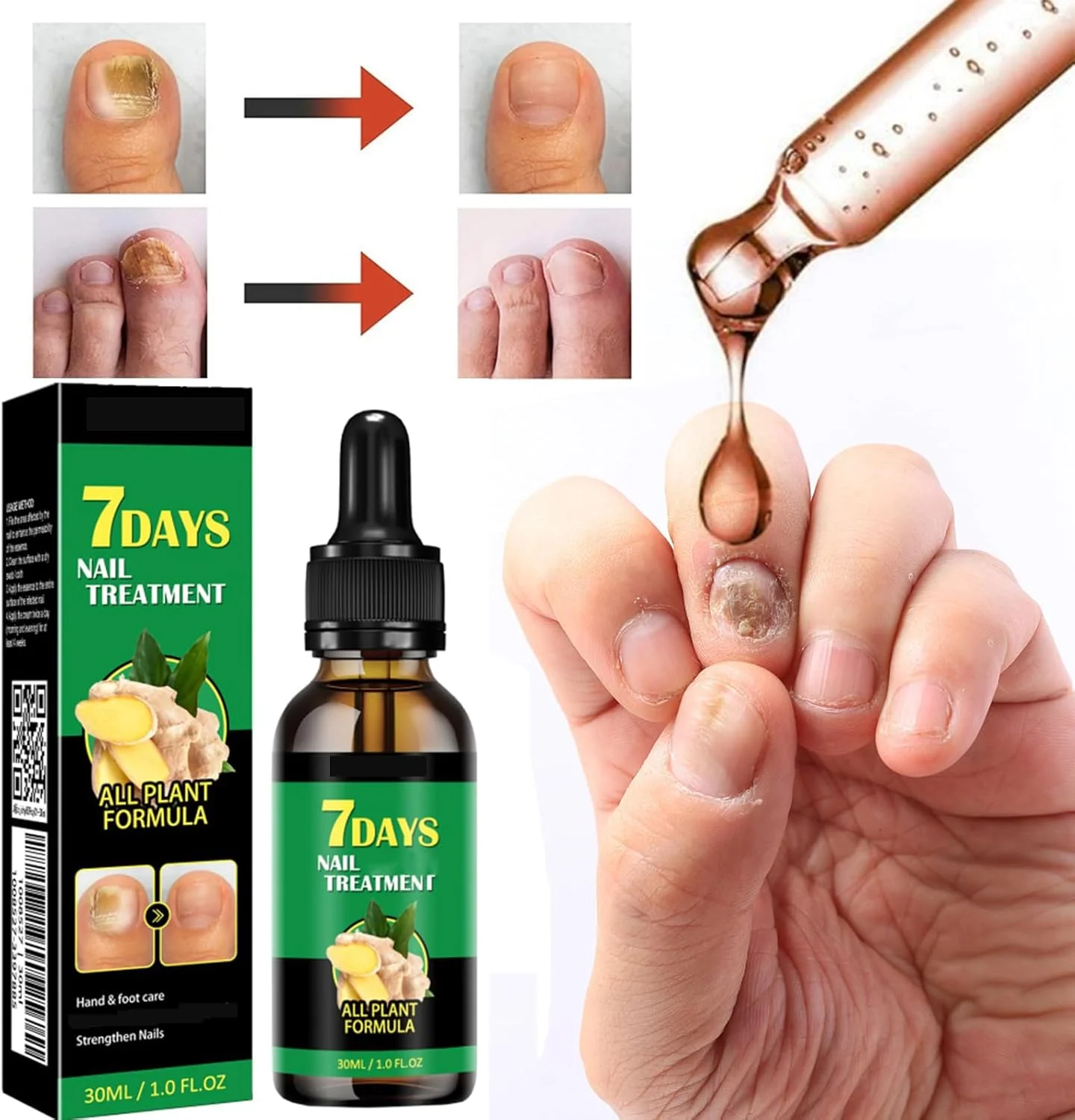 مراقبت از ناخن با زنجبیل، تقویت کننده ناخن، درمان ۷ روزه ناخن، سرم رشد ناخن زنجبیلی، روغن مراقبت از کوتیکول ناخن زنجبیلی، سرم کوتیکول ناخن (۲ عدد، ۳۰ میلی لیتر) مراقبت از ناخن با زنجبیل، تقویت کننده ناخن، درمان ۷ روزه ناخن، سرم رشد ناخن زنجبیلی، روغن مراقبت از کوتیکول ناخن زنجبیلی، سرم کوتیکول ناخن (۲ عدد، ۳۰ میلی لیتر)