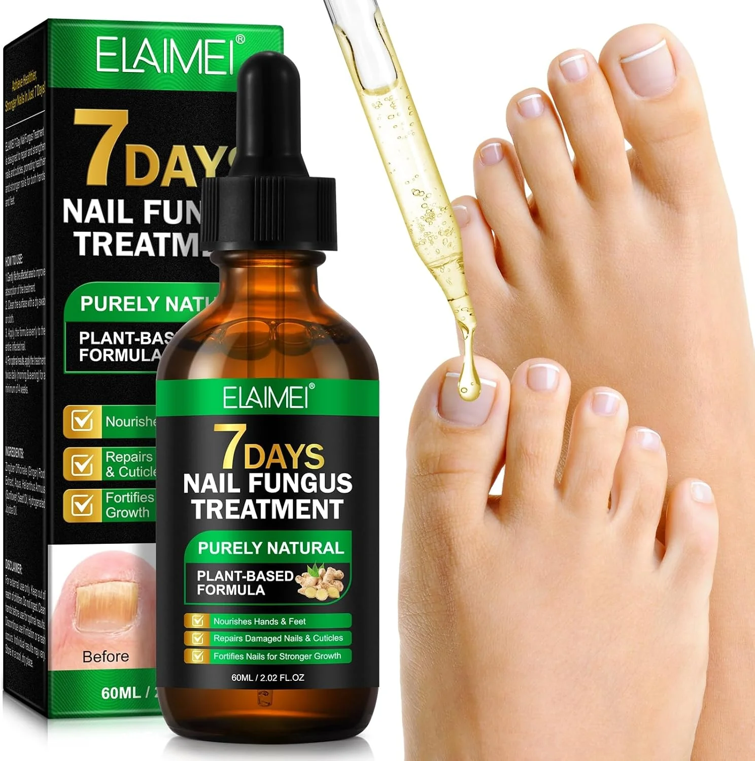 سرم درمان ناخن 60 میلی لیتری MIMI & BEIBEI، سرم رشد ناخن زنجبیلی، ترمیم و تقویت ناخن های آسیب دیده، روغن مراقبت از کوتیکول زنجبیل، آبرسانی عمیق و تغذیه برای حمایت از ناخن های پا و دست سالم