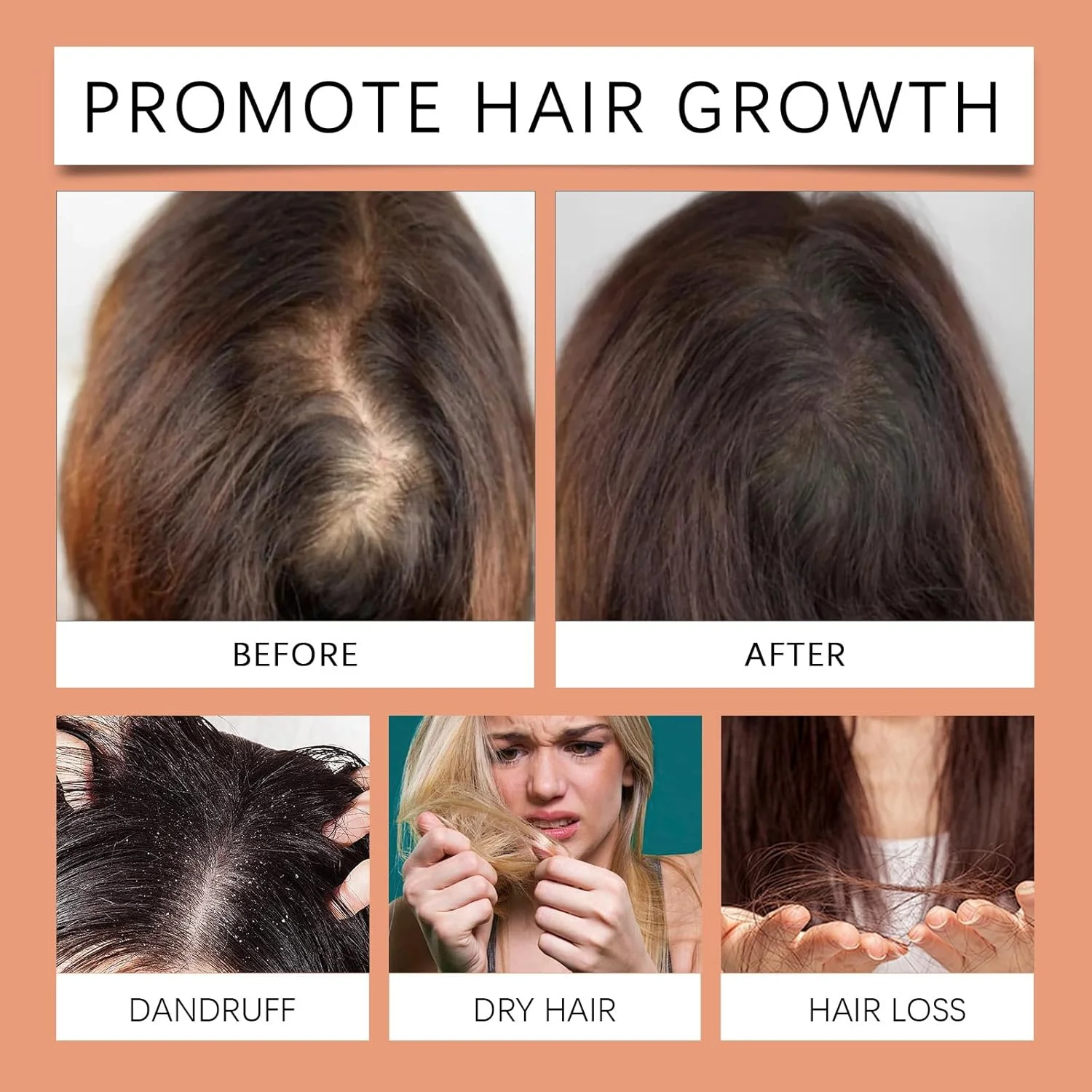 روغن دانه کدو تنبل برای رشد مو، مراقبت از پوست، ناخن ها و کوتیکول ها - تغذیه عمیق پوست سر، تسکین پوست خشک، بهبود جریان خون، مرطوب کننده صورت و بدن، قابل استفاده به عنوان سرم مژه و روغن ضروری برای همه