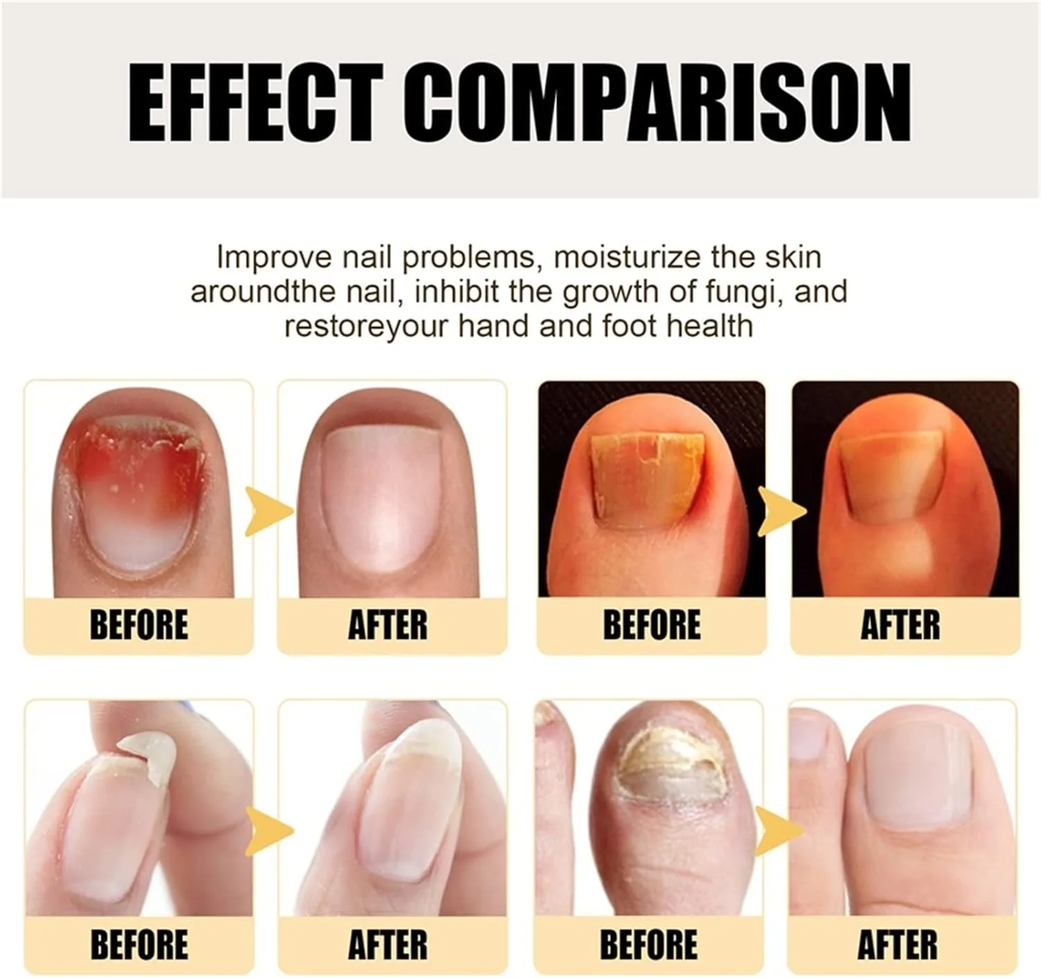 سرم تقویت کننده و رشد ناخن 7 روزه، سرم تقویت کننده و رشد ناخن، روغن کوتیکول ناخن، تقویت کننده ناخن در 1 هفته