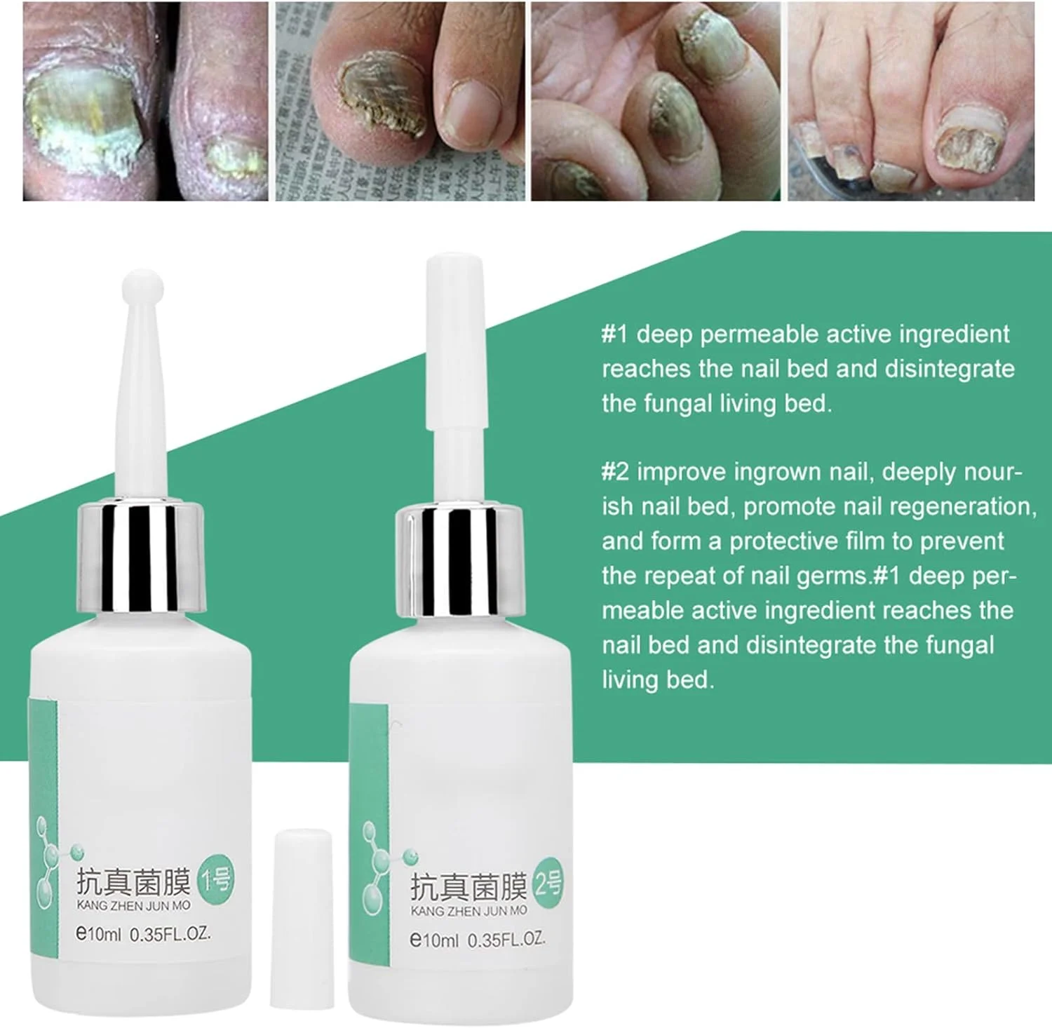 مجموعه سرم ترمیم ناخن 2 عددی 10 میلی لیتری، روغن کوتیکول ناخن با عصاره گیاهی، اسانس مراقبت از ناخن برای سفت و تقویت کردن ناخن پا