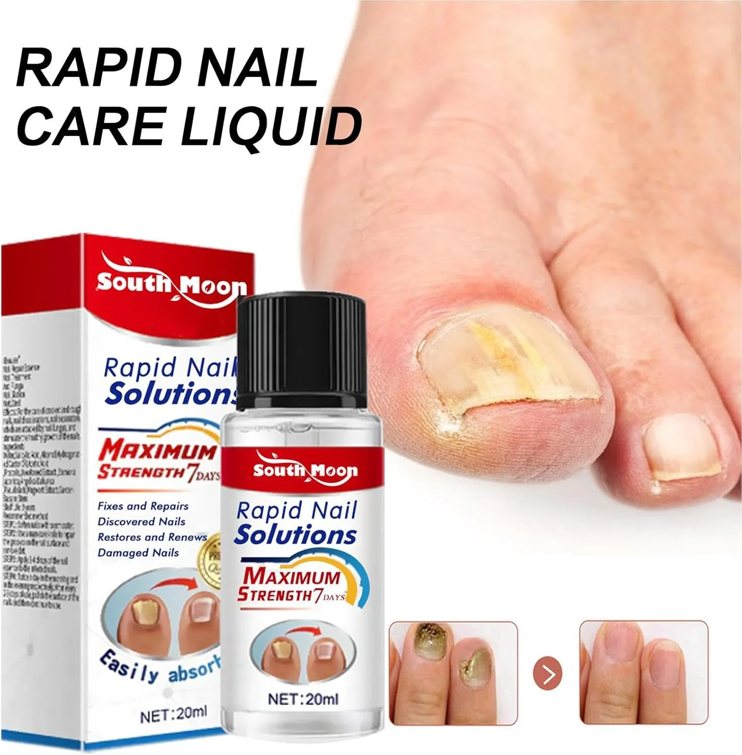 روغن ترمیم ناخن - مایع ترمیم ناخن برای رشد، نرم کننده قابل حمل کوتیکول ناخن، تقویت کننده ملایم کوتیکول ناخن برای بزرگسالان و کودکان روغن ترمیم ناخن - مایع ترمیم ناخن برای رشد، نرم کننده قابل حمل کوتیکول ناخن، تقویت کننده ملایم کوتیکول ناخن برای بزرگسالان و کودکان