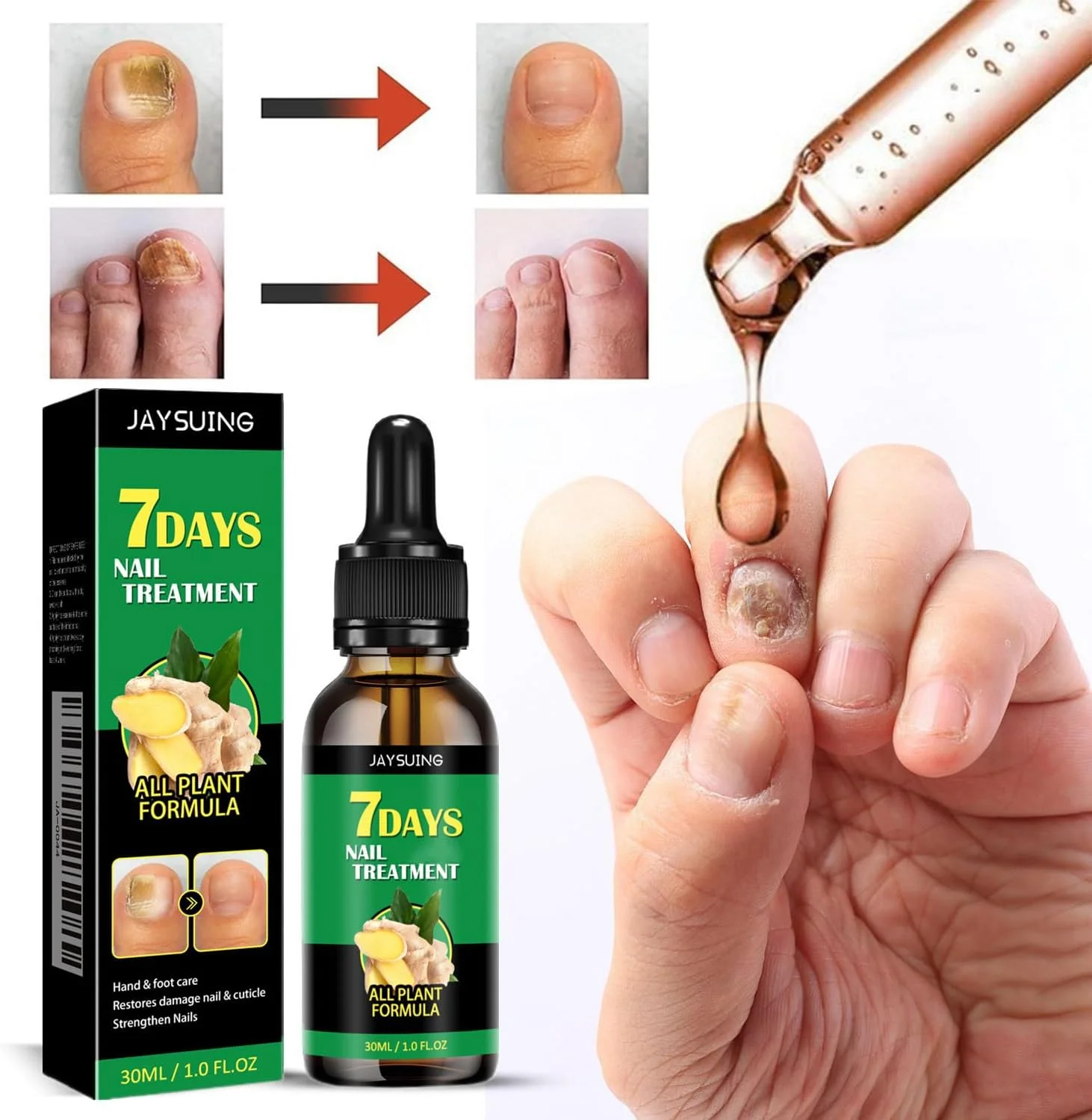 محلول تقویت کننده ناخن زنجبیلی 3 عددی، محلول سرم رشد ناخن 7 روزه، روغن مراقبت از کوتیکول زنجبیلی برای تقویت کننده ناخن، ترویج رشد سالم ناخن (30 میلی لیتر)