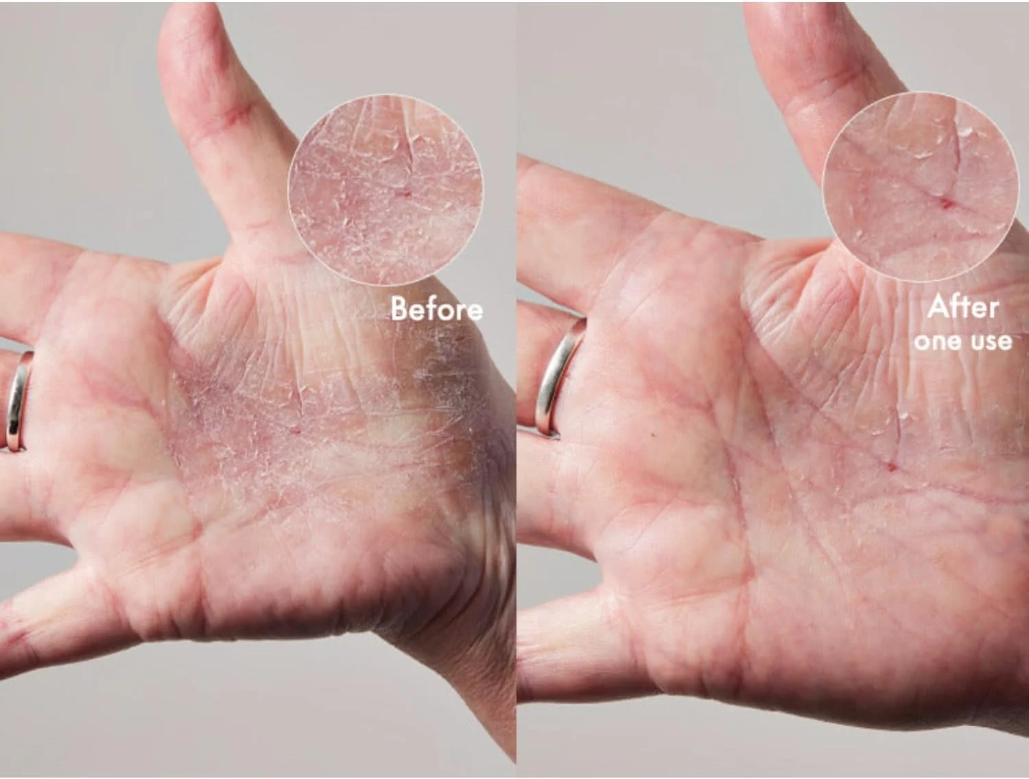 کرم فوق العاده لانو لیپس 101 برای پوست خشک - کرم بدن و مرطوب کننده صورت - کره بدن زده شده برای پوست خشک - حاوی لانو، روغن بادام شیرین، شی باتر و ویتامین E - مراقبت از بدن (60 میلی لیتر) کرم فوق العاده لانو لیپس 101 برای پوست خشک - کرم بدن و مرطوب کننده صورت - کره بدن زده شده برای پوست خشک - حاوی لانو، روغن بادام شیرین، شی باتر و ویتامین E - مراقبت از بدن (60 میلی لیتر)