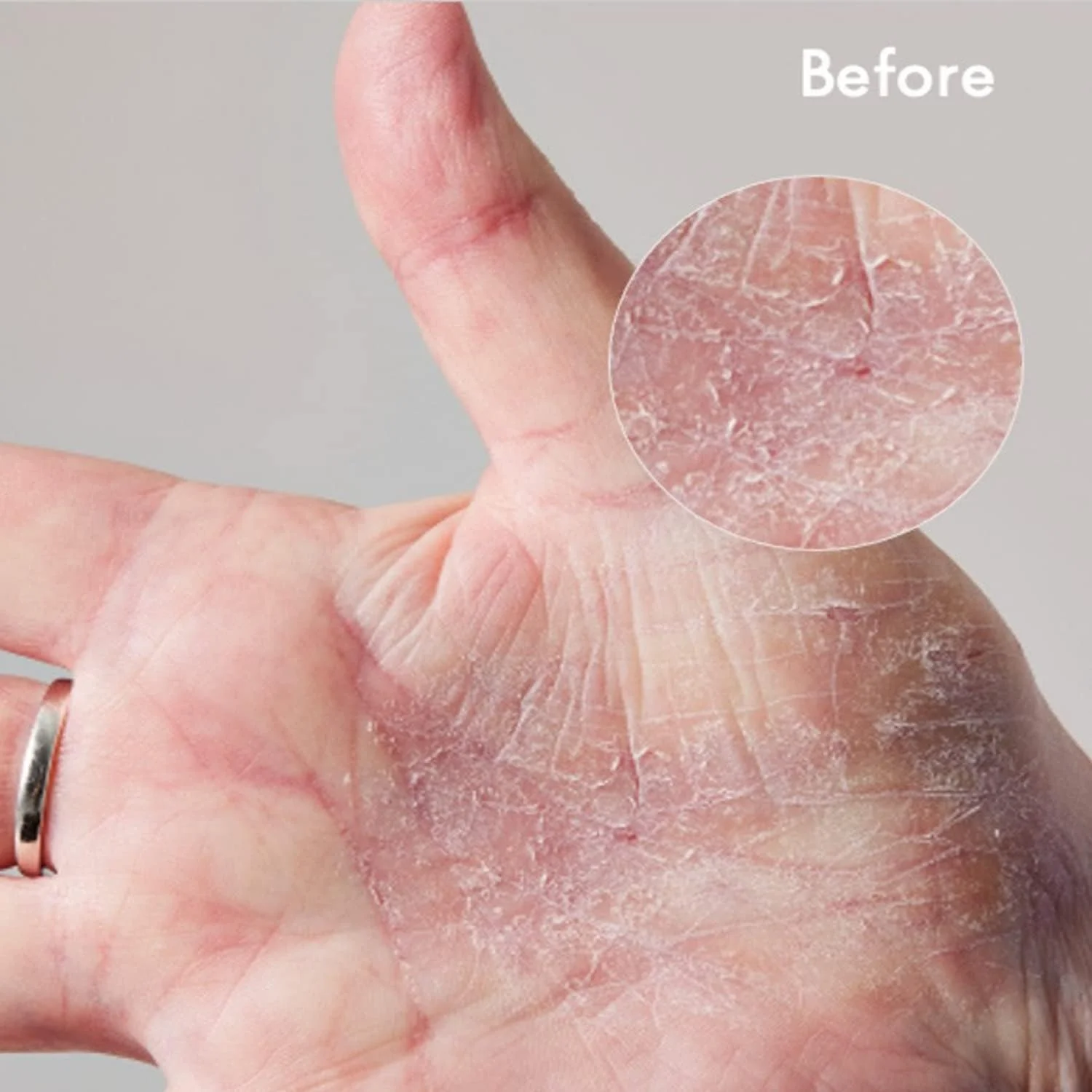 کرم فوق العاده لانو لیپس 101 برای پوست خشک - کرم بدن و مرطوب کننده صورت - کره بدن زده شده برای پوست خشک - حاوی لانو، روغن بادام شیرین، شی باتر و ویتامین E - مراقبت از بدن (60 میلی لیتر) کرم فوق العاده لانو لیپس 101 برای پوست خشک - کرم بدن و مرطوب کننده صورت - کره بدن زده شده برای پوست خشک - حاوی لانو، روغن بادام شیرین، شی باتر و ویتامین E - مراقبت از بدن (60 میلی لیتر)