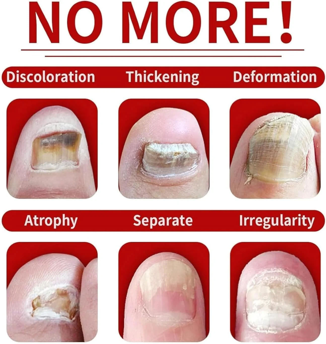 سرم درمان ناخن زنجبیلی 7 روزه، روغن مراقبت از کوتیکول ناخن زنجبیلی، ترمیم کننده چند منظوره ناخن، فرمول گیاهی طبیعی، برای ناخن های زیبا و درخشان (3 عدد)