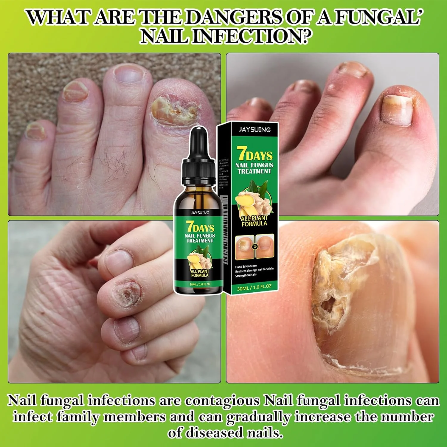 روغن مراقبت از ناخن زنجبیلی، ترمیم کننده، تقویت کننده و محافظت از ناخن های شکننده روغن مراقبت از ناخن زنجبیلی، ترمیم کننده، تقویت کننده و محافظت از ناخن های شکننده