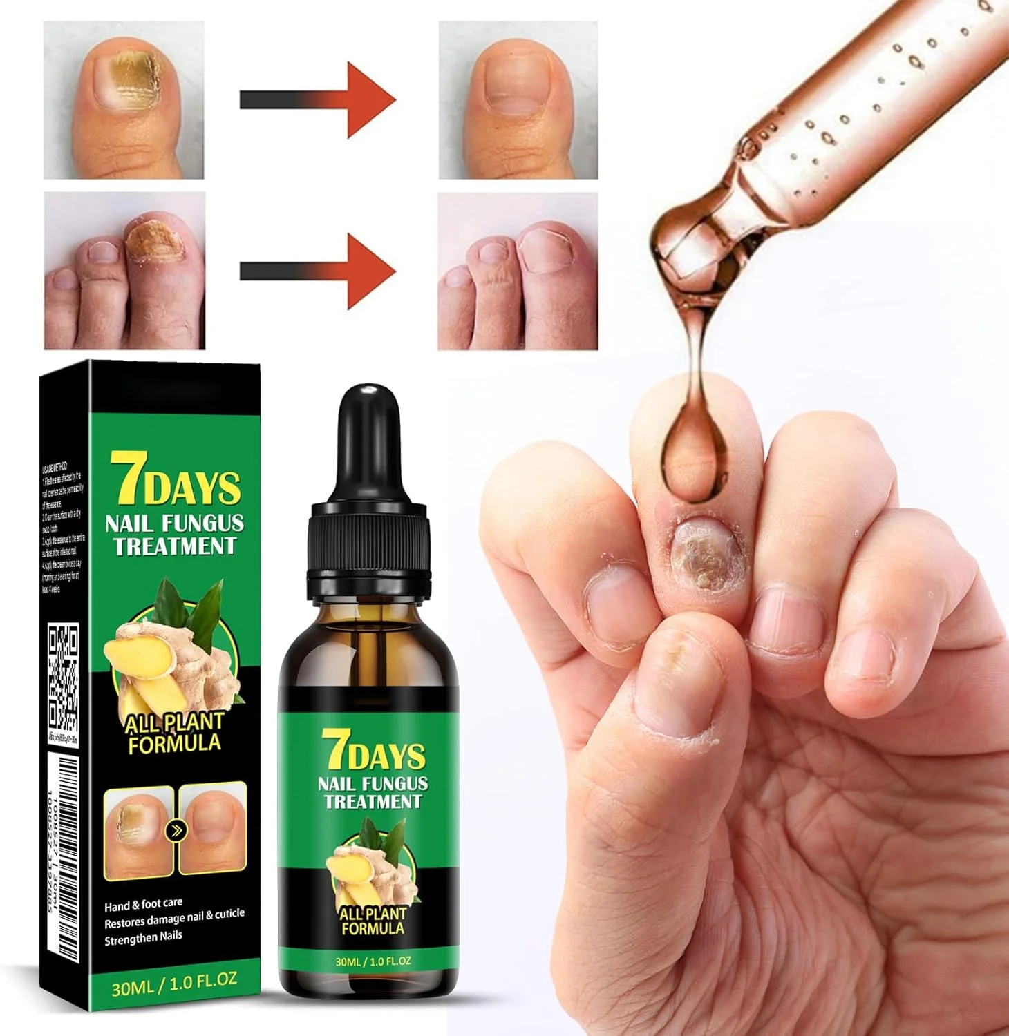 محلول مراقبت از ناخن زنجبیلی، تقویت کننده و مراقبت از ناخن، روغن کوتیکول زنجبیلی برای ناخن، محلول مراقبت از ناخن زنجبیلی 7 روزه، برای تغذیه کوتیکول (3 عدد)