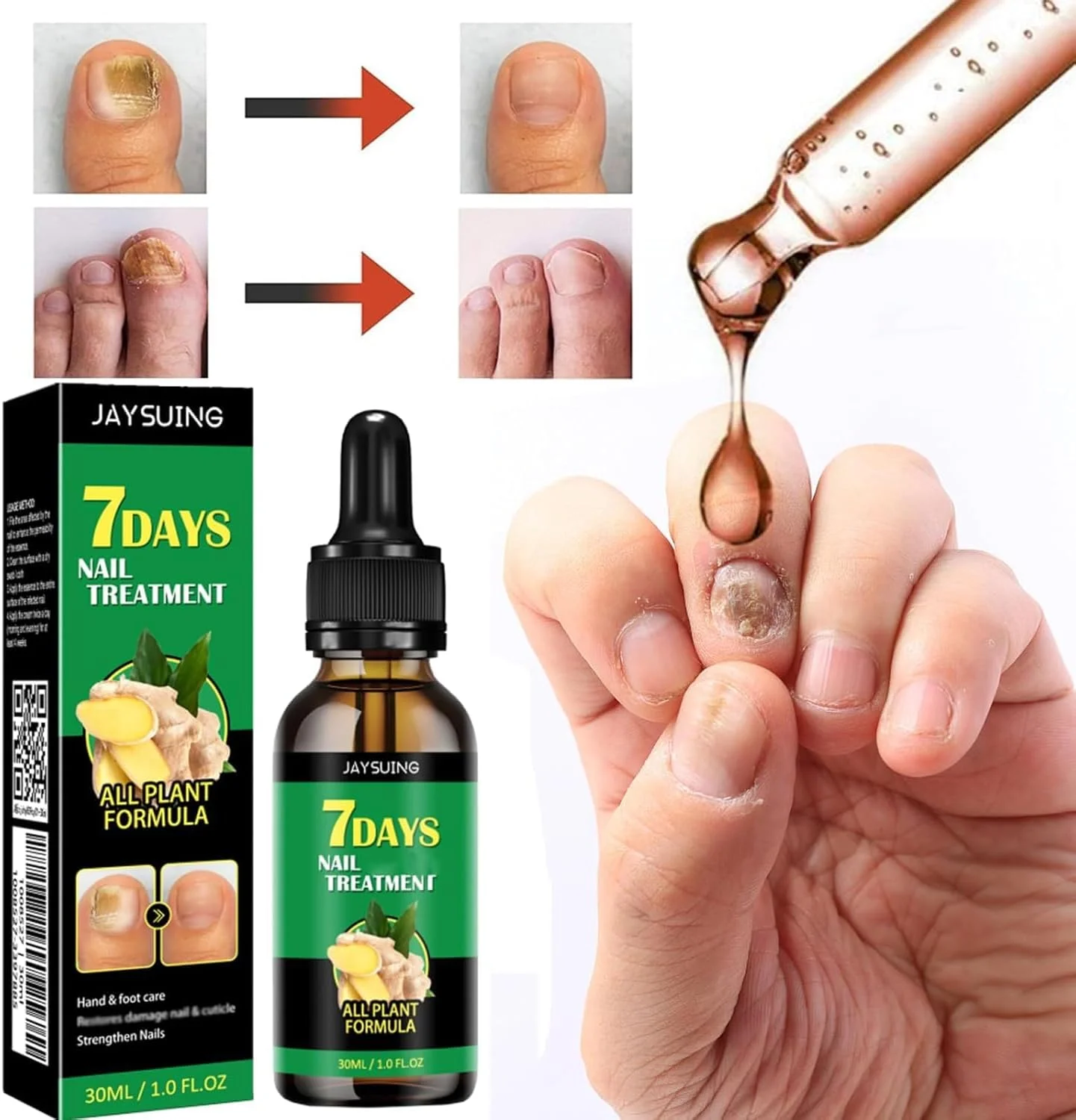 مجموعه ۳ عددی روغن زنجبیل برای ناخن، درمان ناخن با زنجبیل، مراقبت از ناخن، سرم رشد ناخن زنجبیل، روغن مراقبت از کوتیکول ناخن زنجبیل، تقویت کننده ناخن برای ناخن های آسیب دیده مجموعه ۳ عددی روغن زنجبیل برای ناخن، درمان ناخن با زنجبیل، مراقبت از ناخن، سرم رشد ناخن زنجبیل، روغن مراقبت از کوتیکول ناخن زنجبیل، تقویت کننده ناخن برای ناخن های آسیب دیده