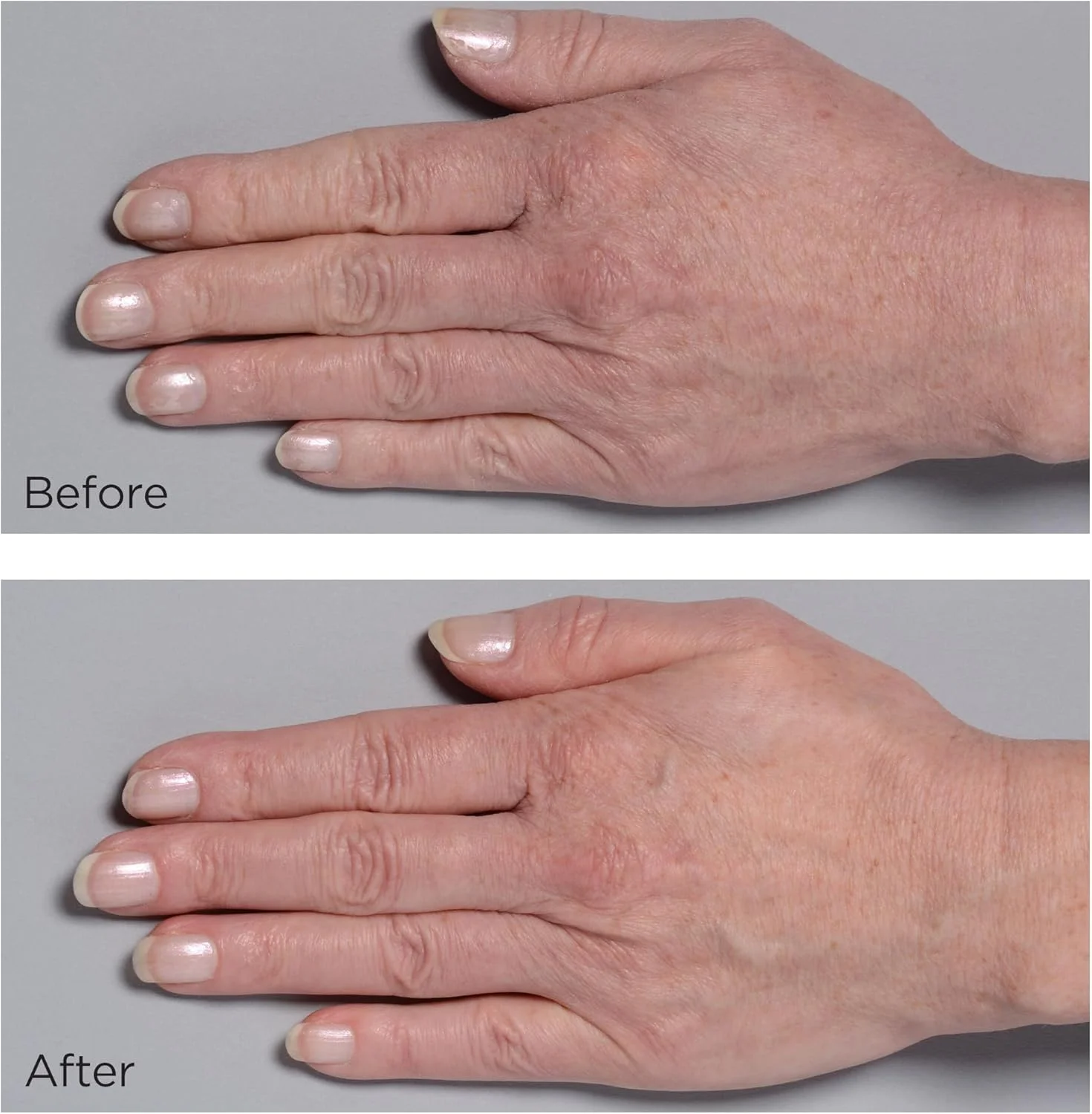کرم دست پلاسما سرد دکتر Perricone MD: تقویت کننده، نرم کننده و احیا کننده پوست دست، کاهش ظاهر لکه های تیره، رگ ها و تغییر رنگ پوست. این کرم ابریشمی به سرعت جذب می شود و به طور محسوسی پوست را سفت، محکم و روشن می کند، در حالی که ظاهر خطوط ریز و چین و چروک را صاف می کند و خاصیت ارتجاعی پوست را با گذشت زمان بهبود می بخشد. کرم دست پلاسما سرد دکتر Perricone MD: تقویت کننده، نرم کننده و احیا کننده پوست دست، کاهش ظاهر لکه های تیره، رگ ها و تغییر رنگ پوست. این کرم ابریشمی به سرعت جذب می شود و به طور محسوسی پوست را سفت، محکم و روشن می کند، در حالی که ظاهر خطوط ریز و چین و چروک را صاف می کند و خاصیت ارتجاعی پوست را با گذشت زمان بهبود می بخشد.