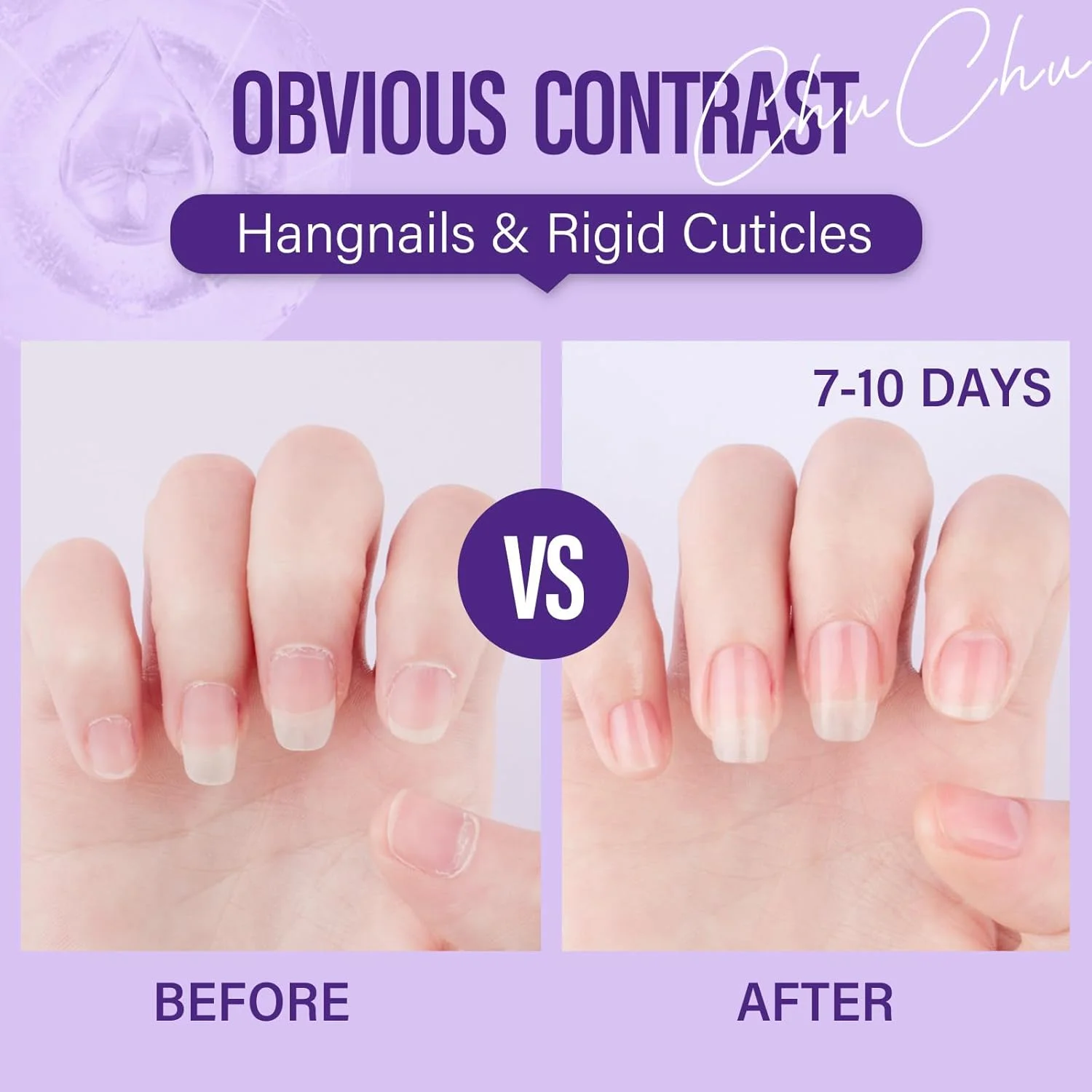 روغن ناخن چوچو برای مراقبت از ناخن: 15 میلی لیتر روغن کوتیکول ناخن اسطوخودوس جوجوبا ویتامین B و E - روغن کوتیکول ناخن برای تقویت ناخن های ترک خورده و جلوگیری از پارگی پوست، وگان