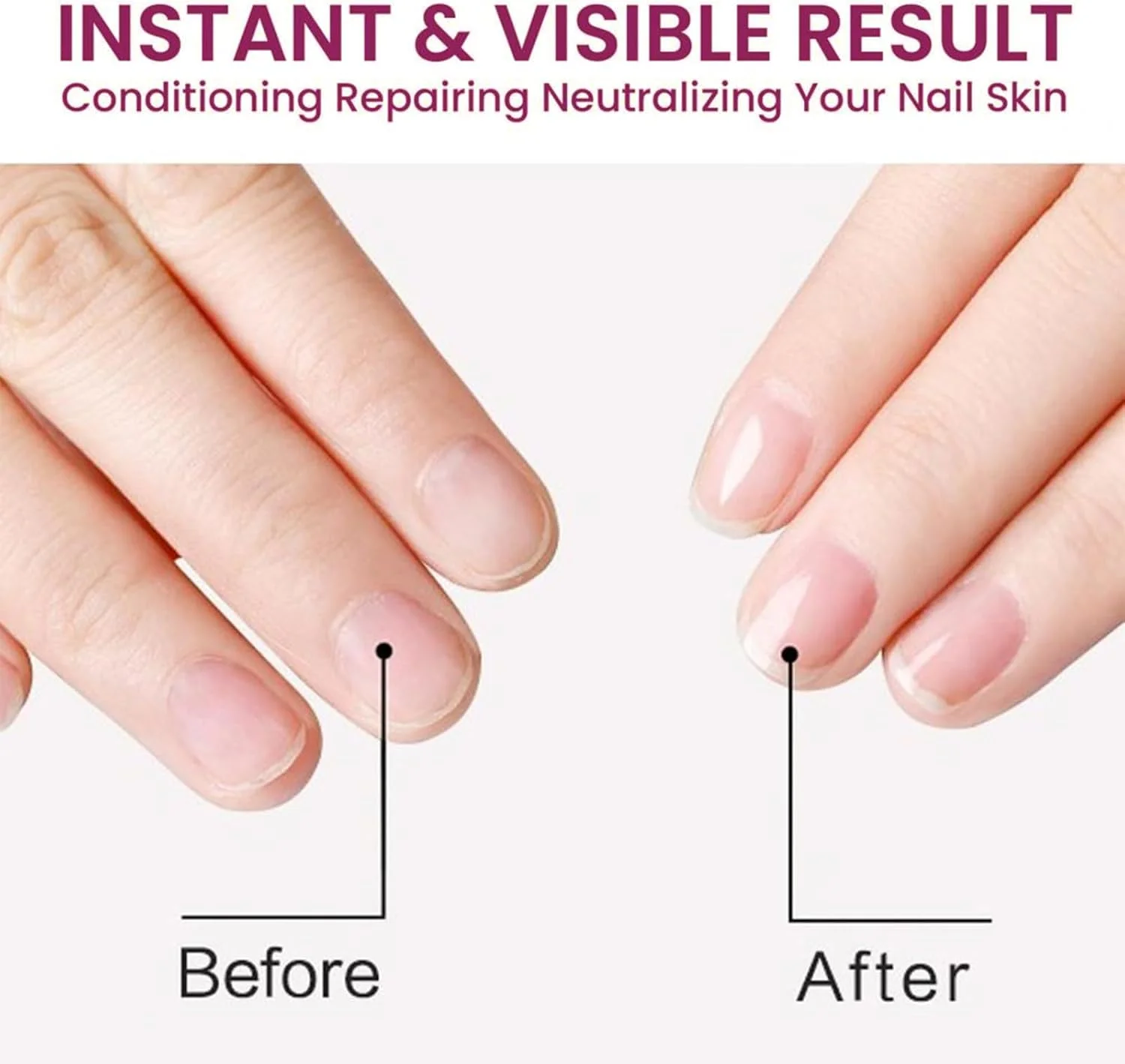 روغن کوتیکول ناخن 15 میلی لیتر حاوی ویتامین E و B ارگانیک - روغن کوتیکول ناخن - روغن جوجوبا برای ناخن - روغن ناخن، تسکین دهنده و مرطوب کننده با طراحی قطره چکان برای مراقبت و ترمیم ناخن های خشک و زبر