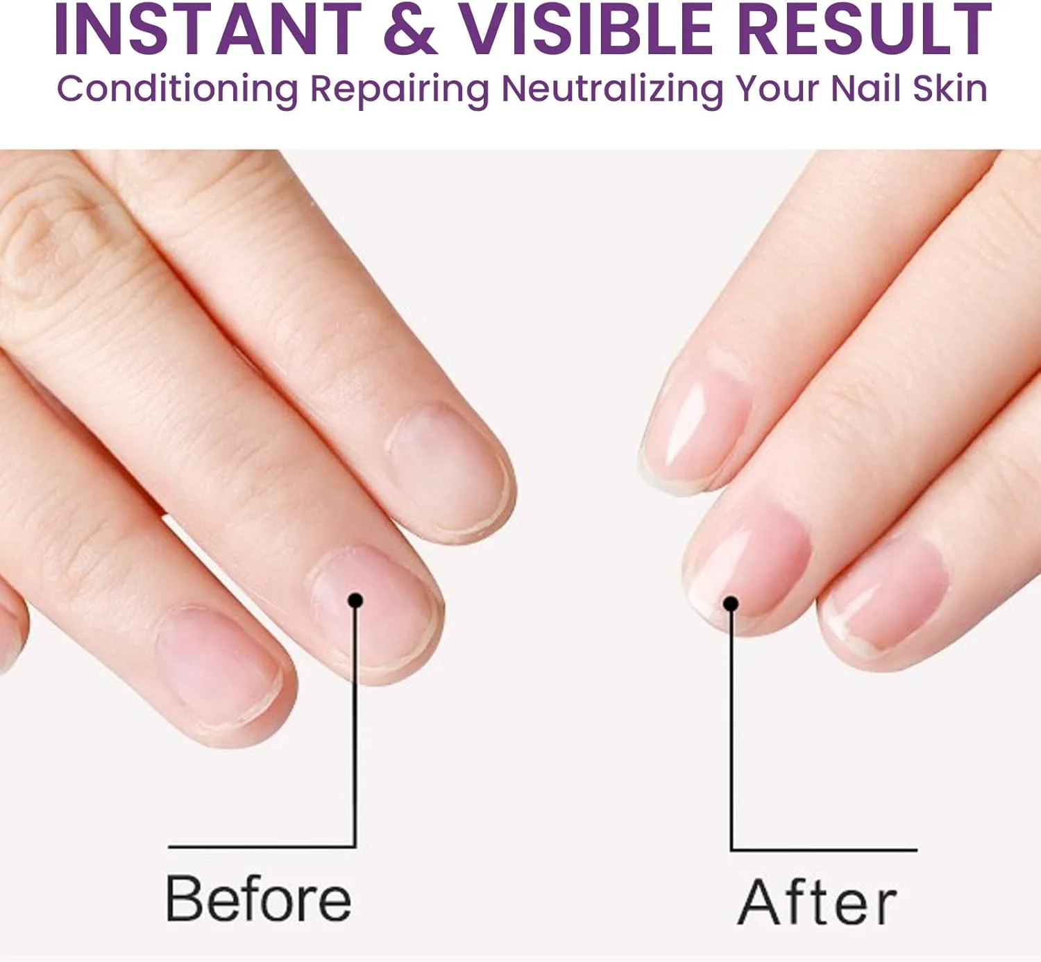 روغن تقویت کننده کوتیکول ناخن - روغن ارگانیک ناخن و کوتیکول، سرم تقویت کننده و رشد ناخن 7 روزه، روغن احیا کننده کوتیکول، روغن درمانی ناخن برای ناخن های آسیب دیده، سرم ترمیم ناخن (2 عدد)