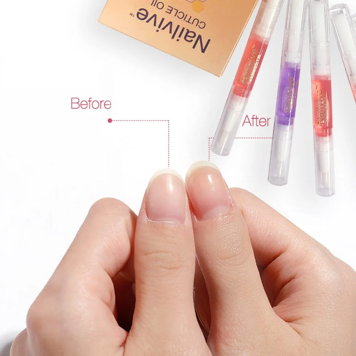 روغن کوتیکول ناخن Nailvive، شش قلم، روغن های احیا کننده، مجموعه طبیعی منحصر به فرد از روغن های غنی برای تامین رطوبت، محافظت و تغذیه کوتیکول های خشک، شکننده و ترک خورده، ناخن ها و پوست (بسته 6 عددی روغن کوتیکول) روغن کوتیکول ناخن Nailvive، شش قلم، روغن های احیا کننده، مجموعه طبیعی منحصر به فرد از روغن های غنی برای تامین رطوبت، محافظت و تغذیه کوتیکول های خشک، شکننده و ترک خورده، ناخن ها و پوست (بسته 6 عددی روغن کوتیکول)