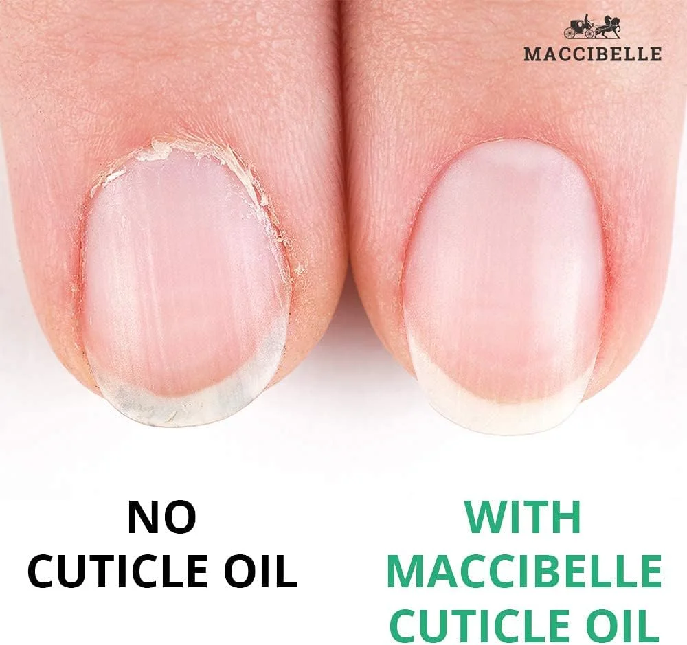روغن کوتیکول ناخن Maccibelle، سایز بزرگ برای کوتیکول های خشک و ترک خورده (118 میلی لیتر، آناناس) روغن کوتیکول ناخن Maccibelle، سایز بزرگ برای کوتیکول های خشک و ترک خورده (118 میلی لیتر، آناناس)